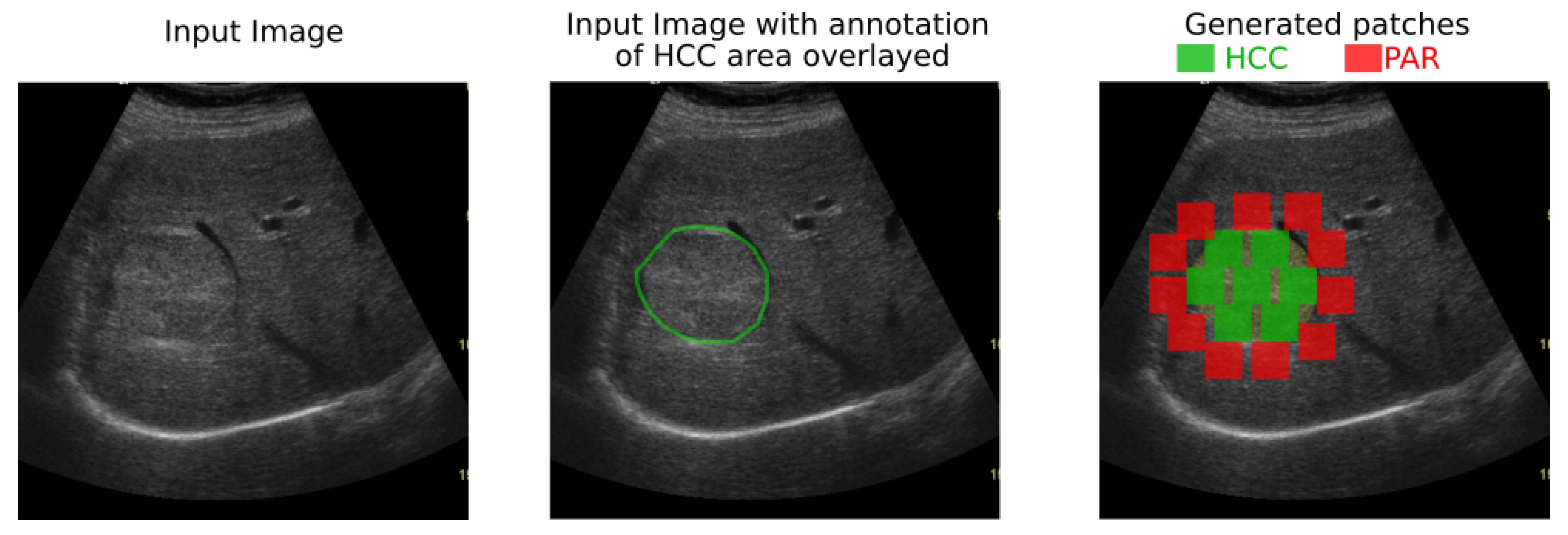 Sensors 20 03085 g002