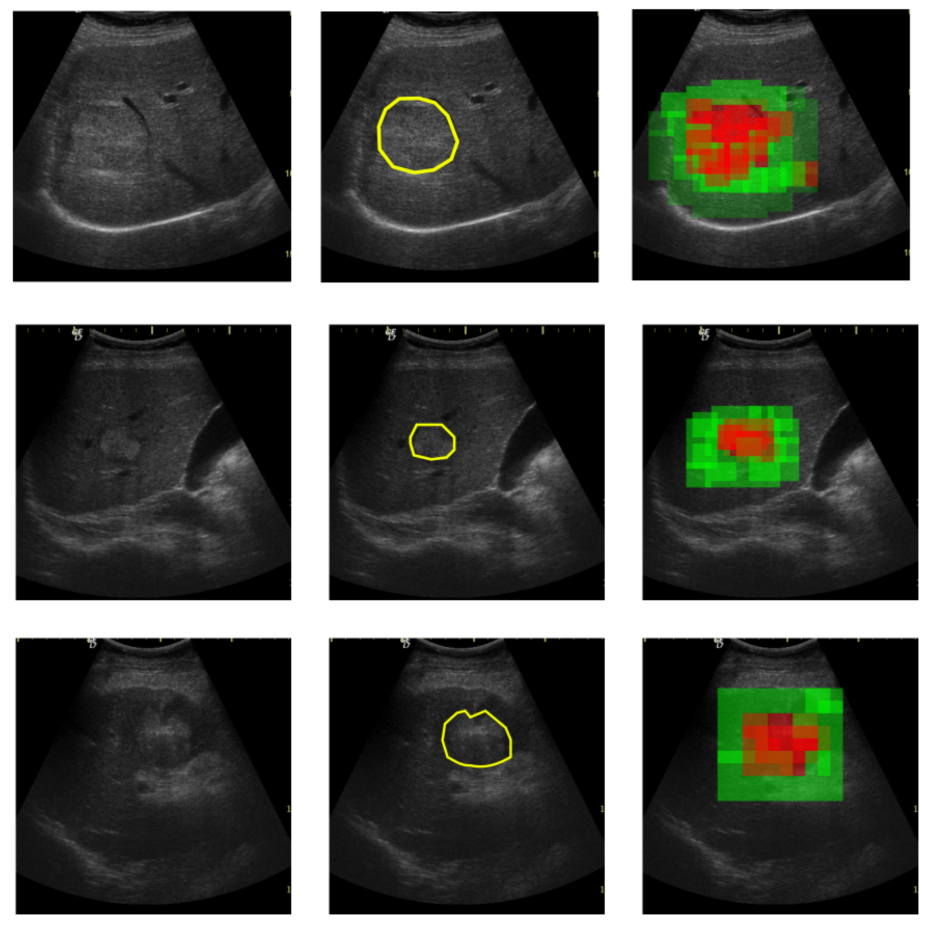 Sensors 20 03085 g015