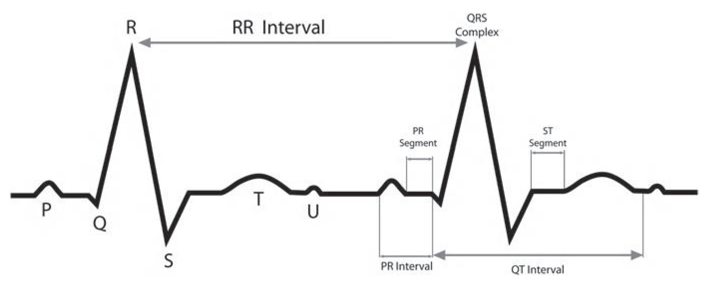 Sensors 20 03139 g001