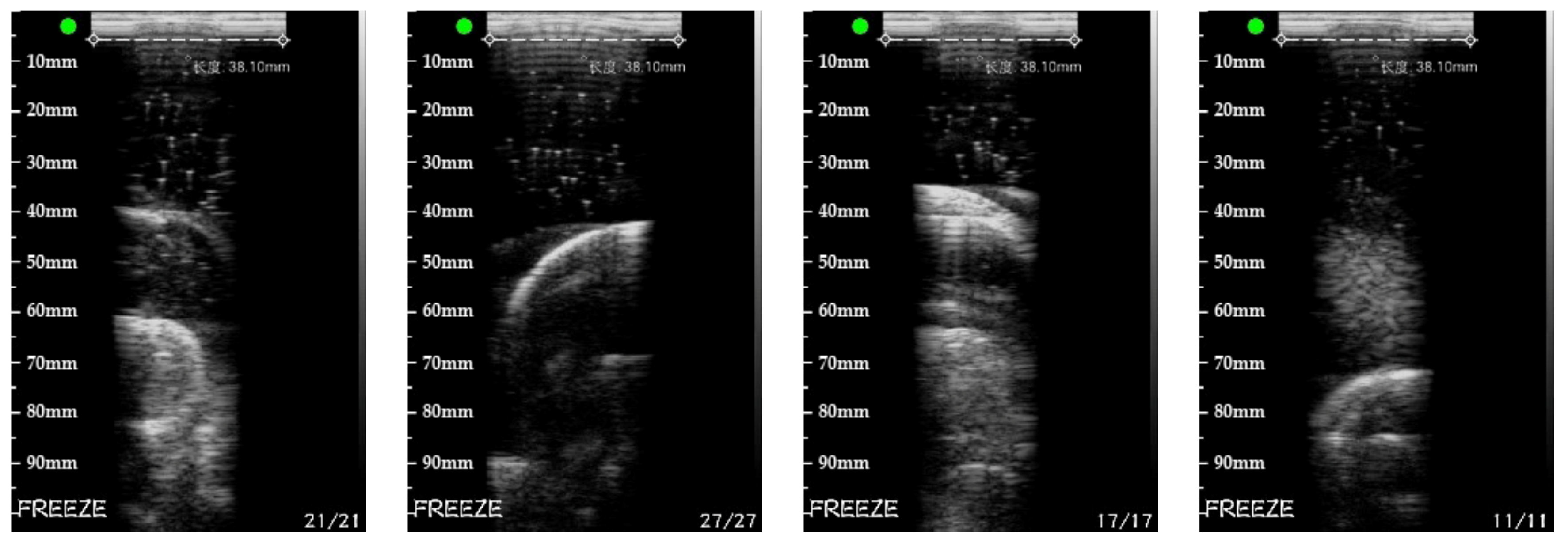 Sensors 20 03146 g024b Sensors 20 03146 g024b