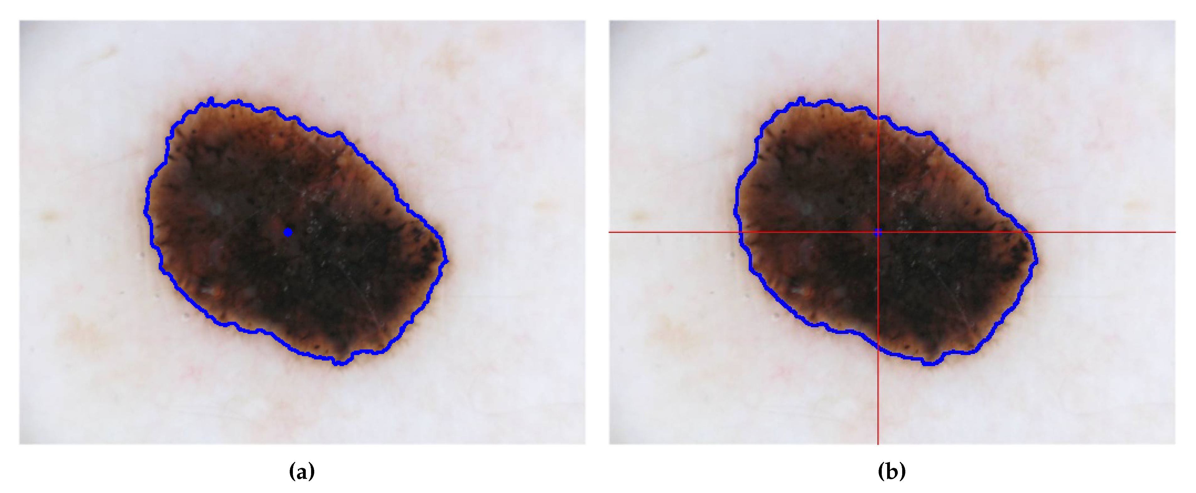 Sensors 20 03168 g003