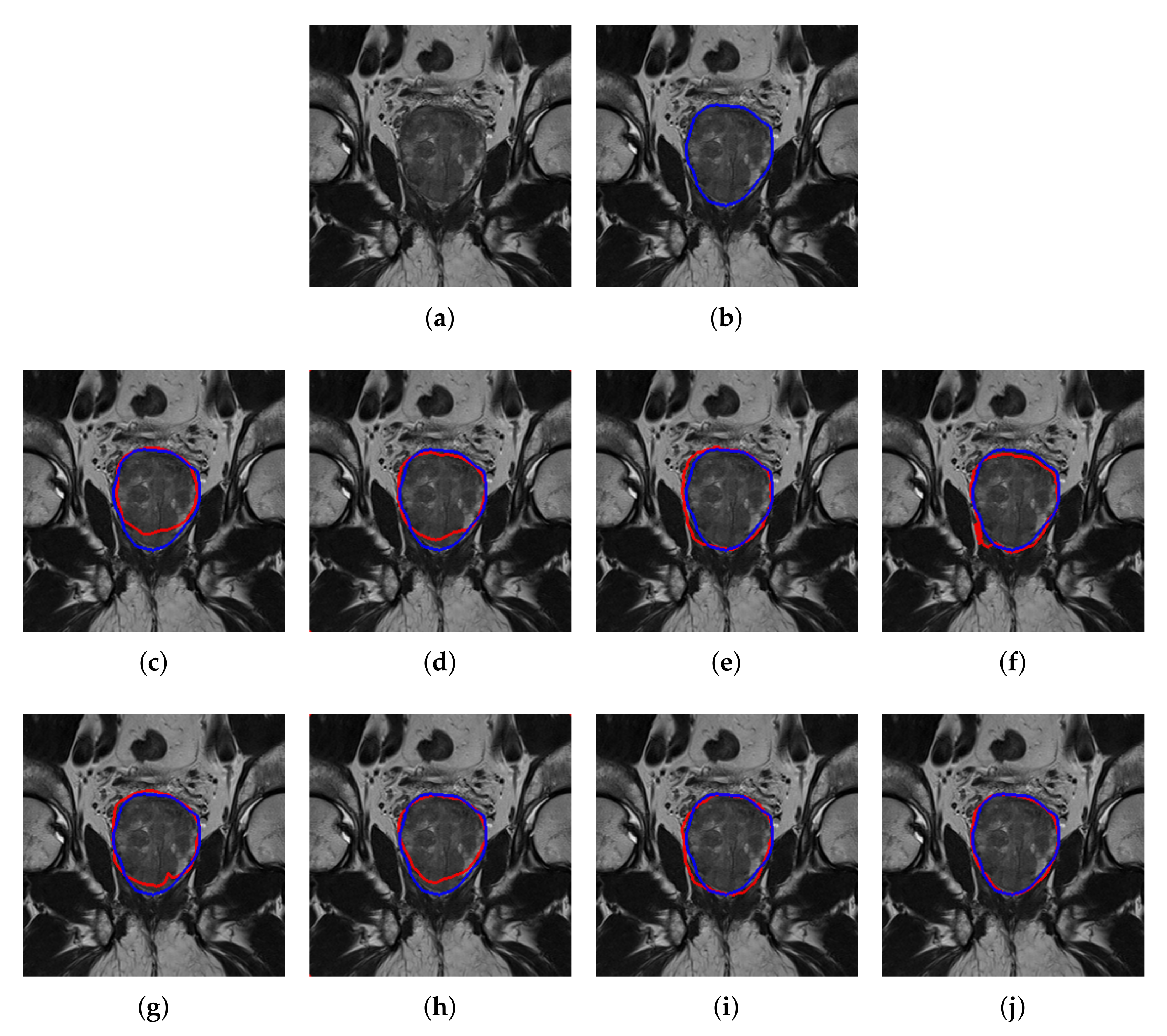 Sensors 20 03183 g007 Sensors 20 03183 g007