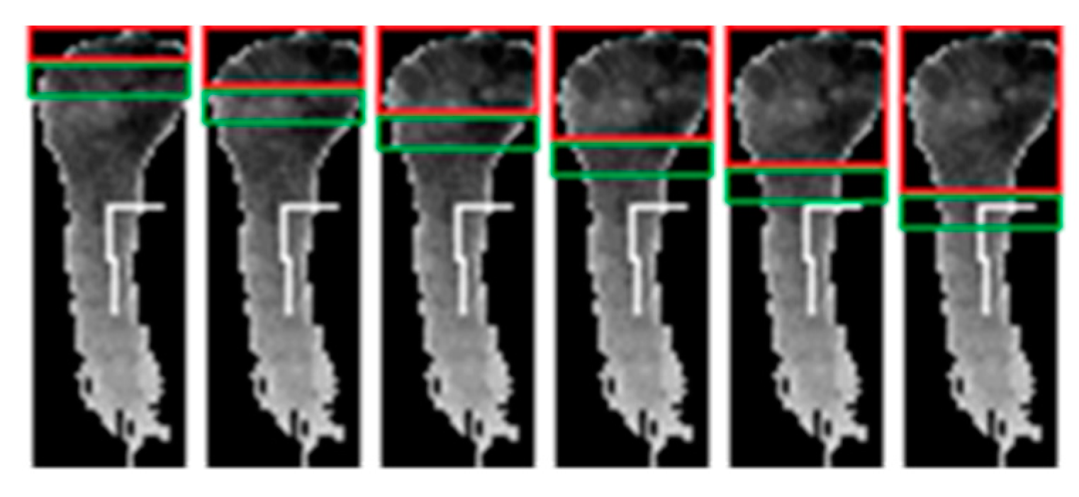 Sensors 20 03226 g006 Sensors 20 03226 g006