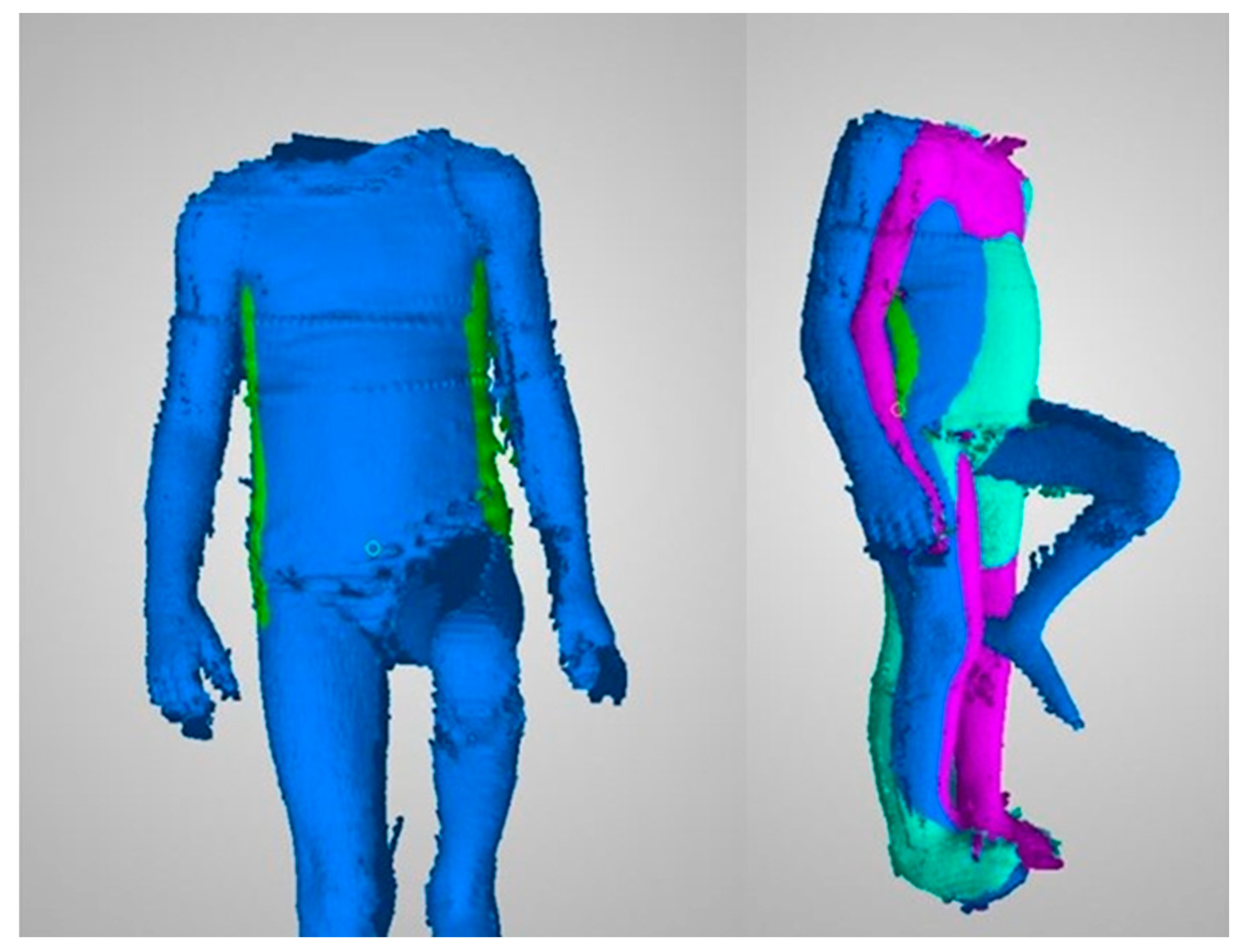 Sensors 20 03232 g003