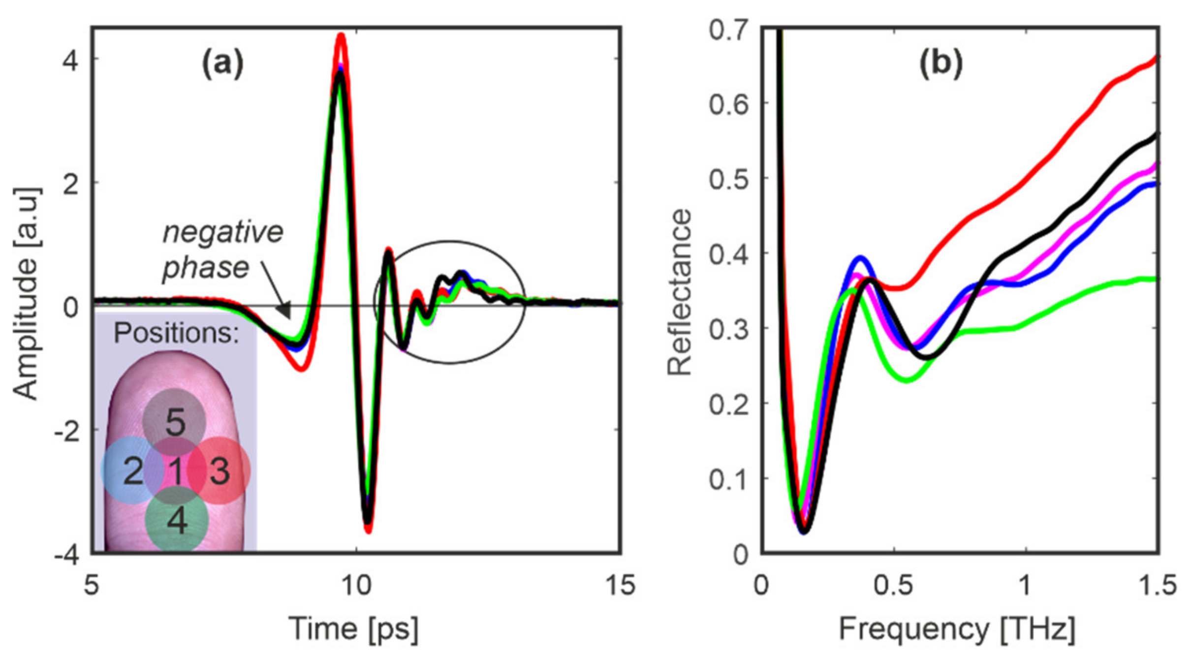 Sensors 20 03379 g011 Sensors 20 03379 g011
