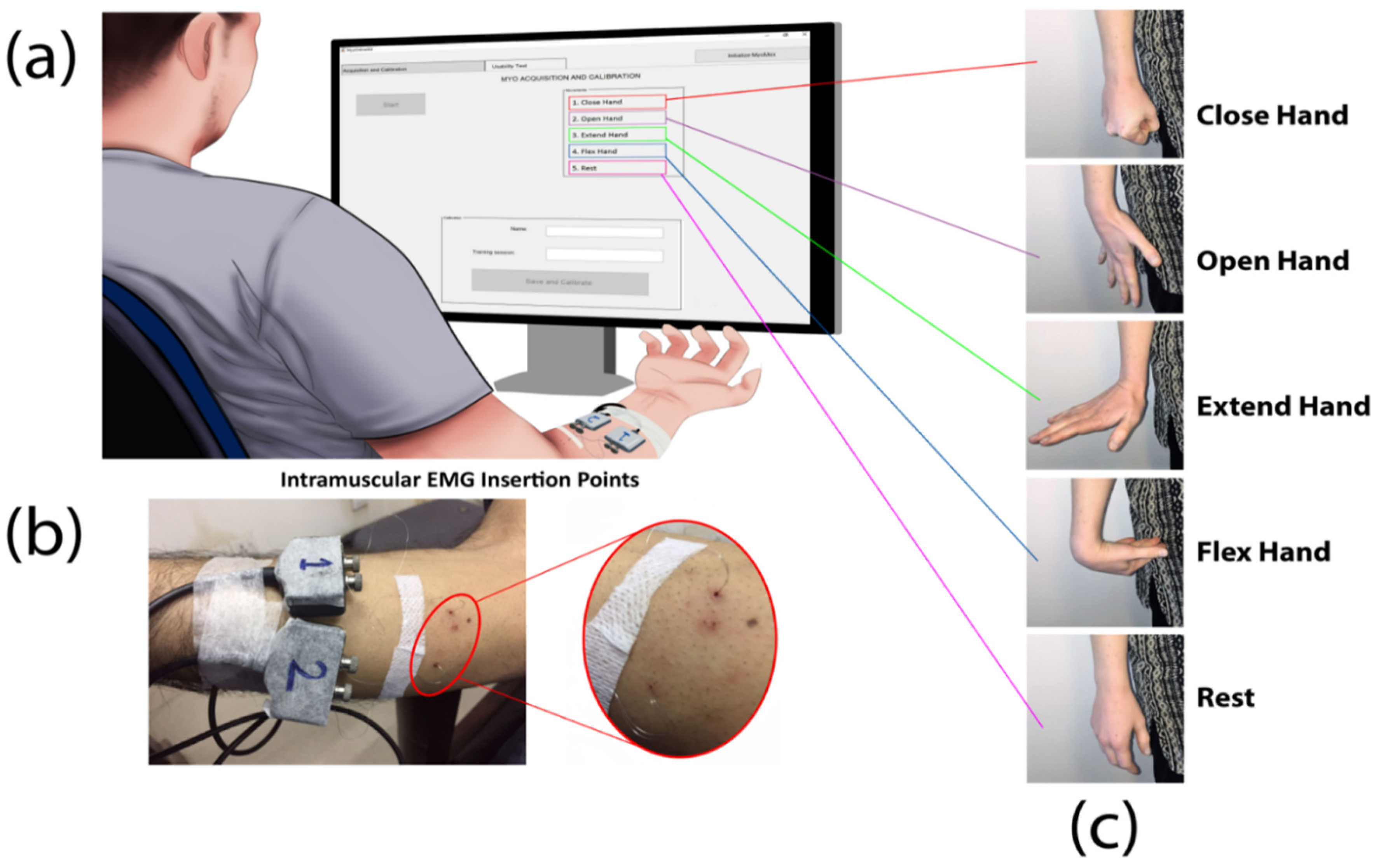 Sensors Free Full Text A Multiday Evaluation Of Real Time Intramuscular Emg Usability With Ann Html