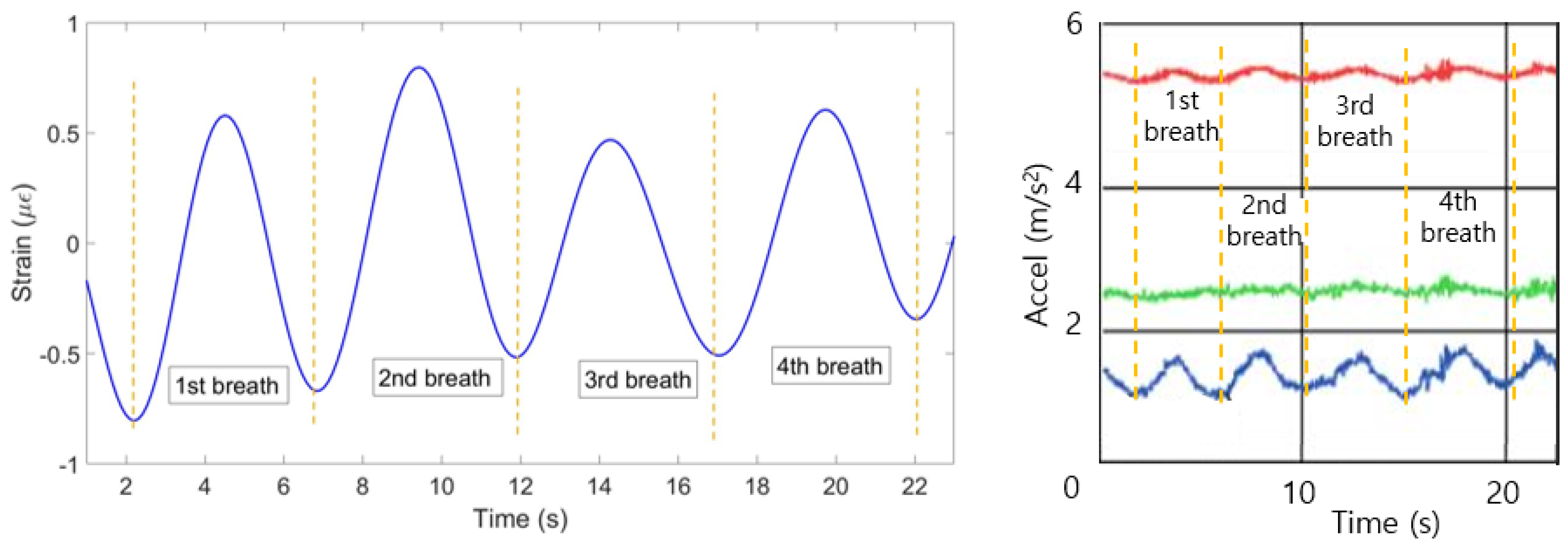 Sensors 20 03408 g017