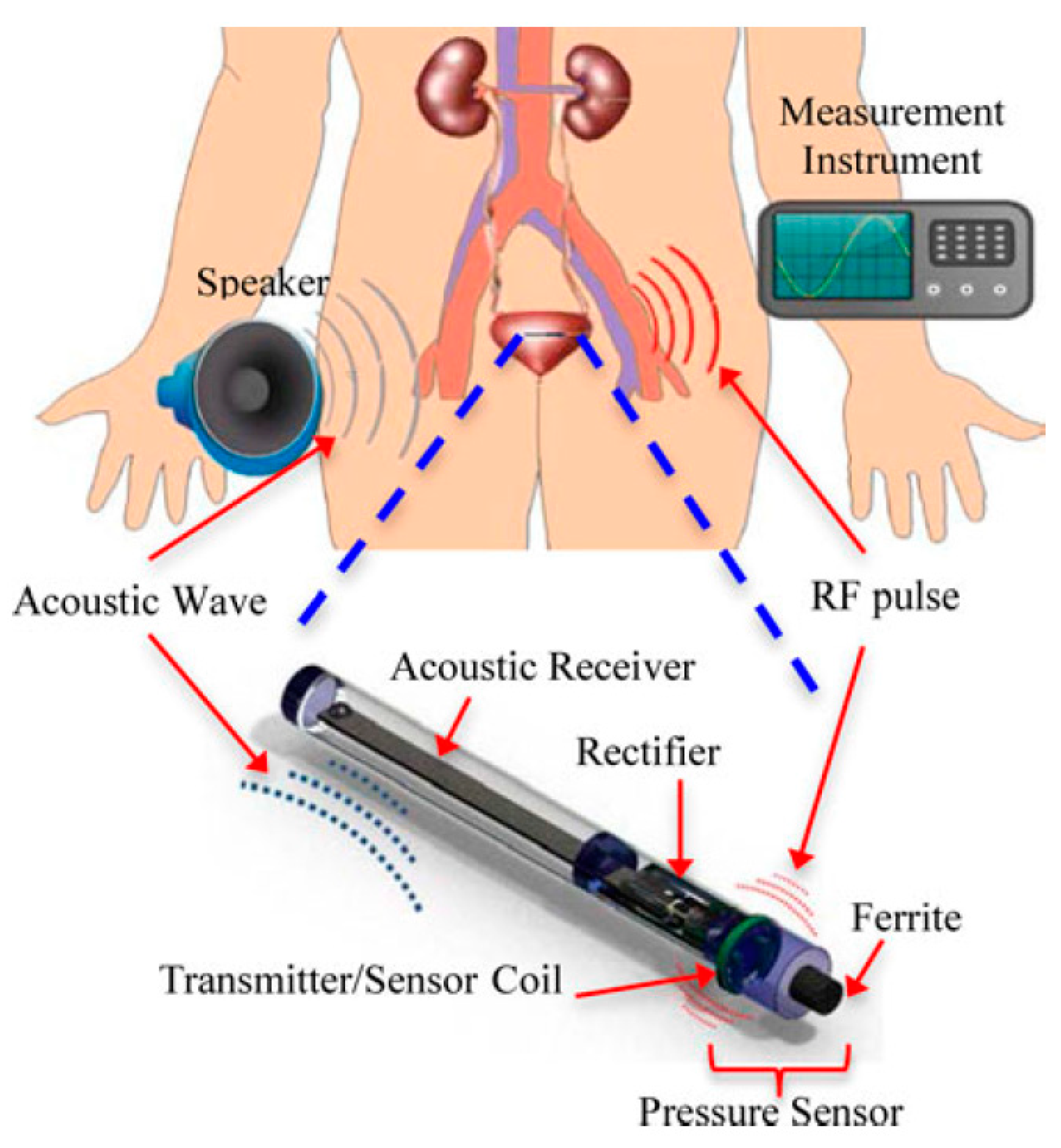 Sensors 20 03487 g046