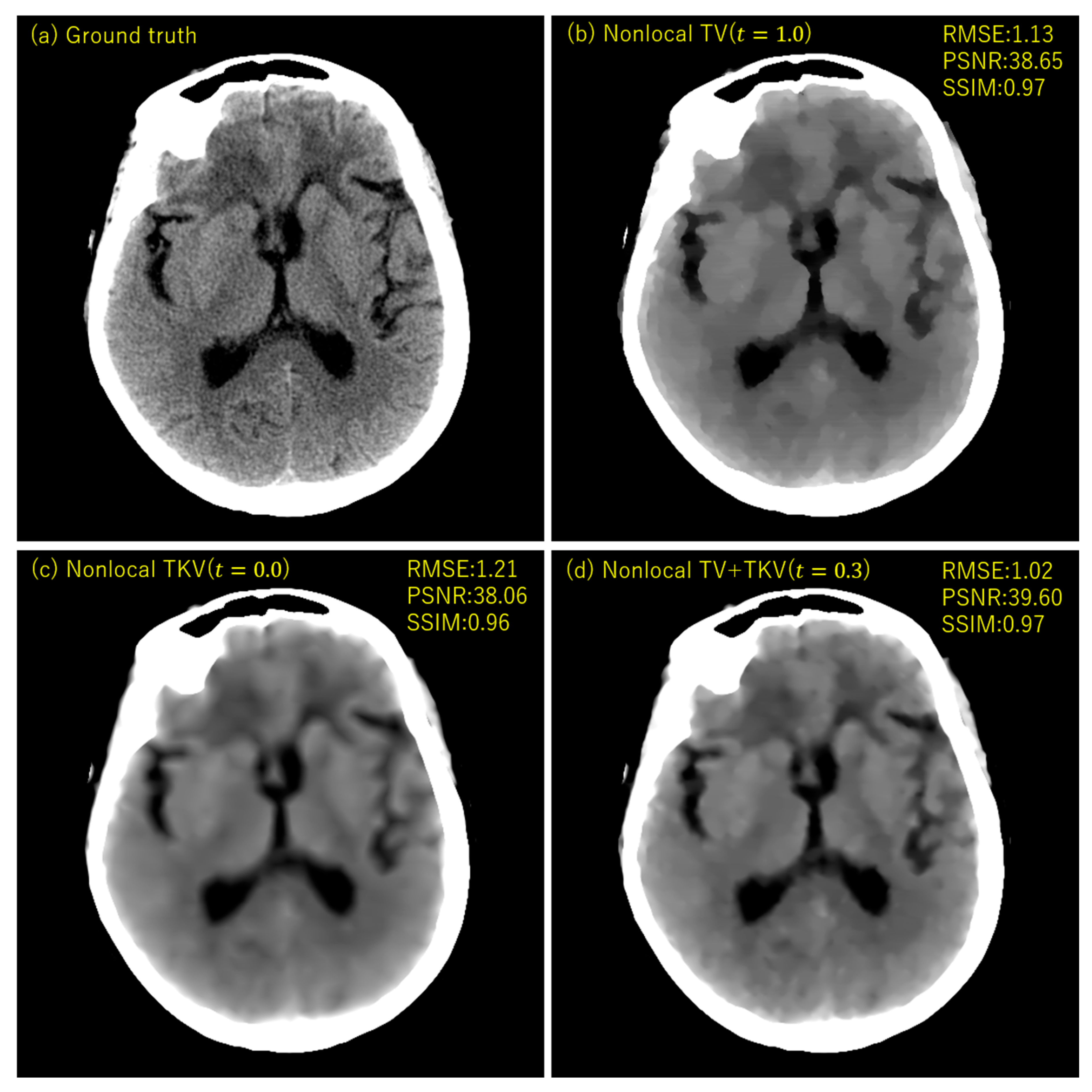 Sensors 20 03494 g006