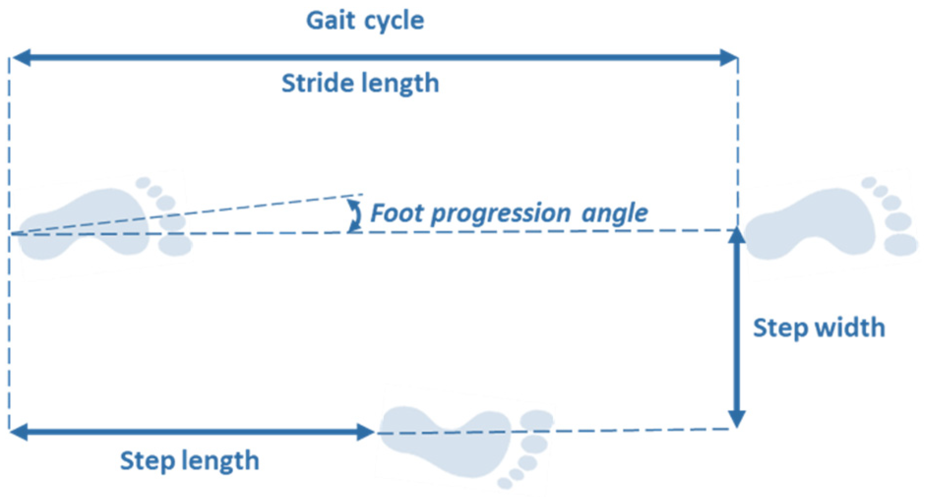 Sensors Free Full Text Gait Analysis In Parkinson S Disease An Overview Of The Most Accurate Markers For Diagnosis And Symptoms Monitoring Html