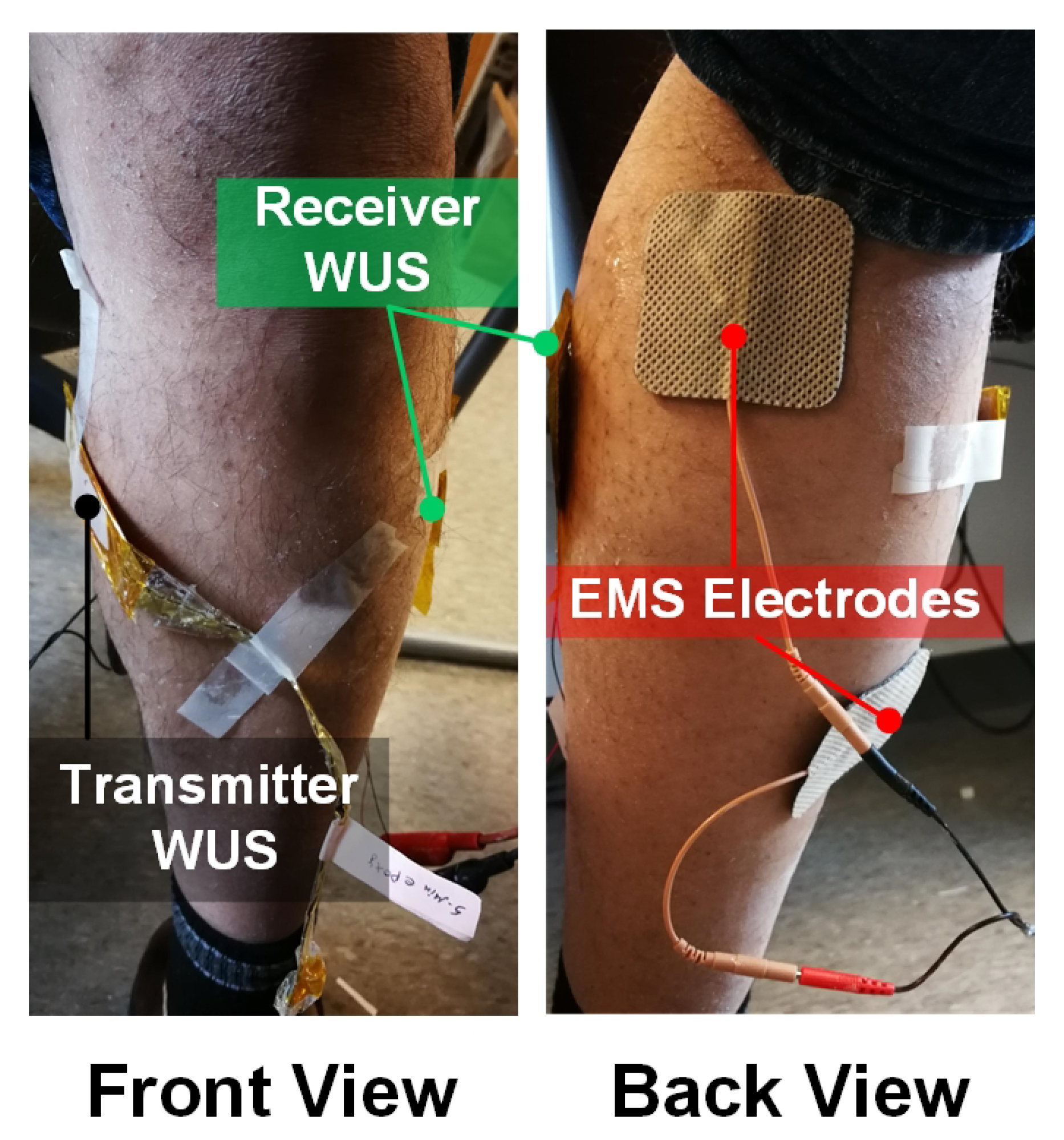 Sensors 20 03616 g002