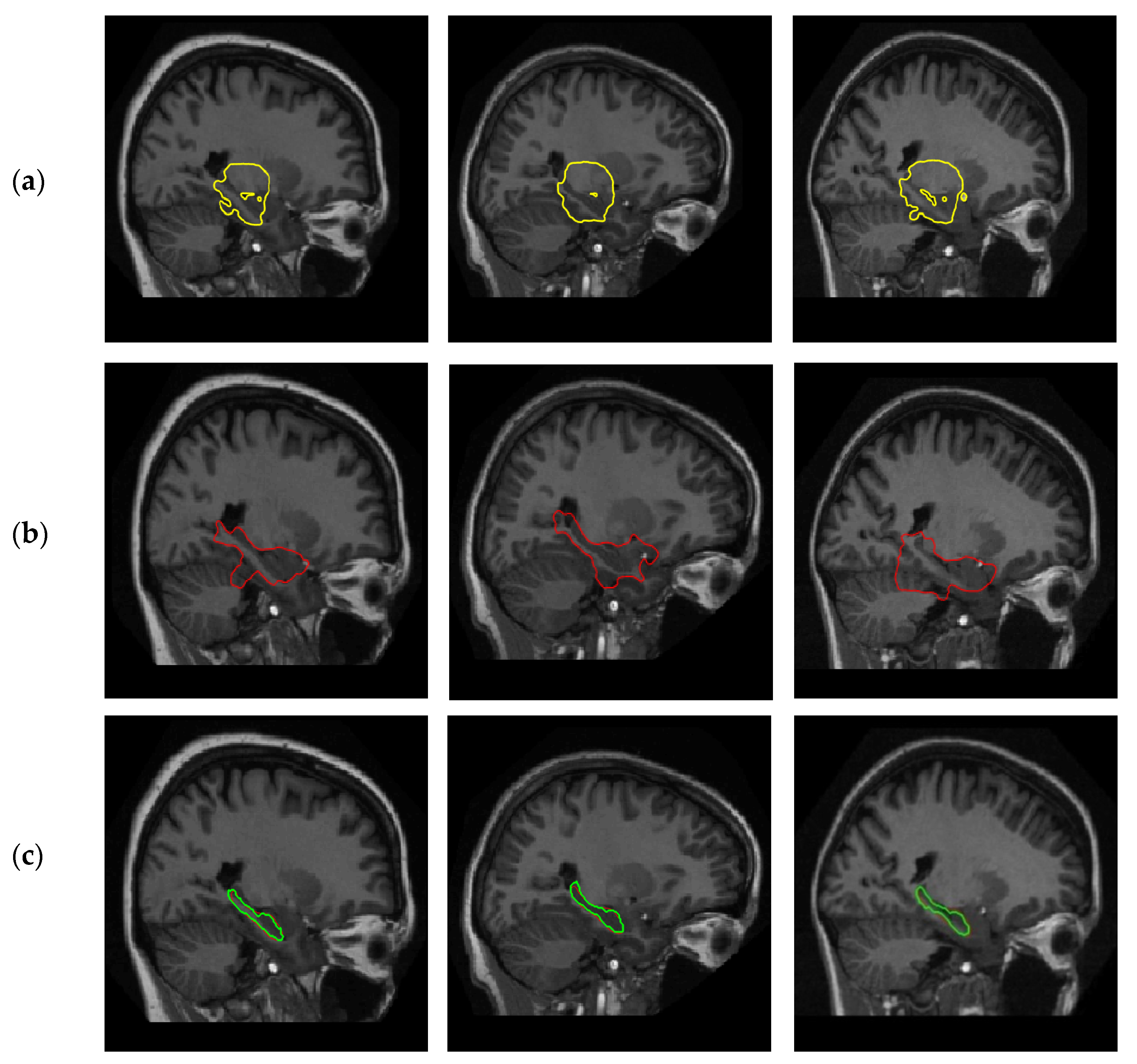 Sensors 20 03628 g005 Sensors 20 03628 g005