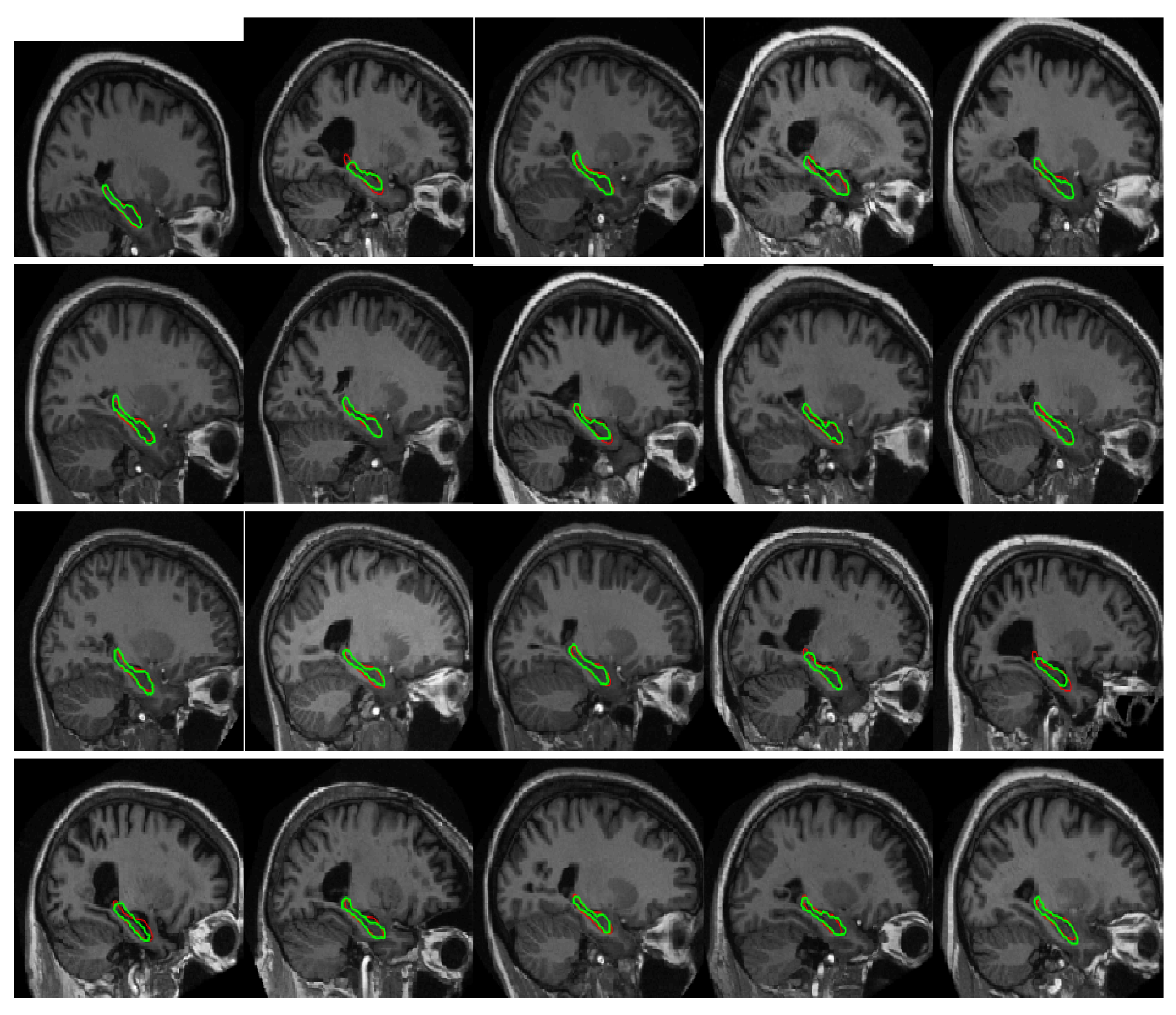 Sensors 20 03628 g009 Sensors 20 03628 g009