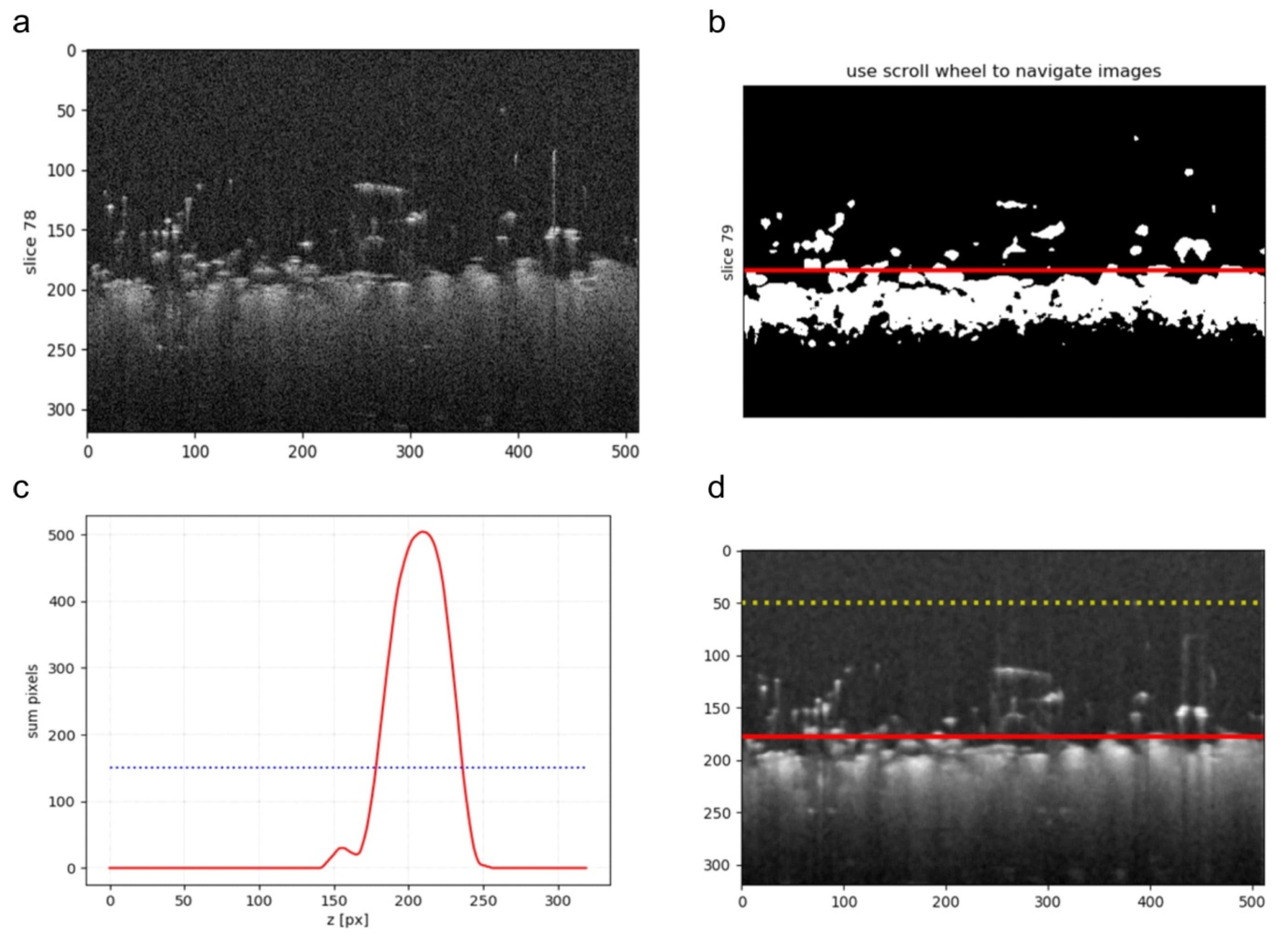 Sensors Free Full Text A Method For The Assessment Of Textile Pilling Tendency Using Optical Coherence Tomography Html Sensors Free Full Text A Method For The Assessment Of Textile Pilling Tendency Using Optical Coherence Tomography Html