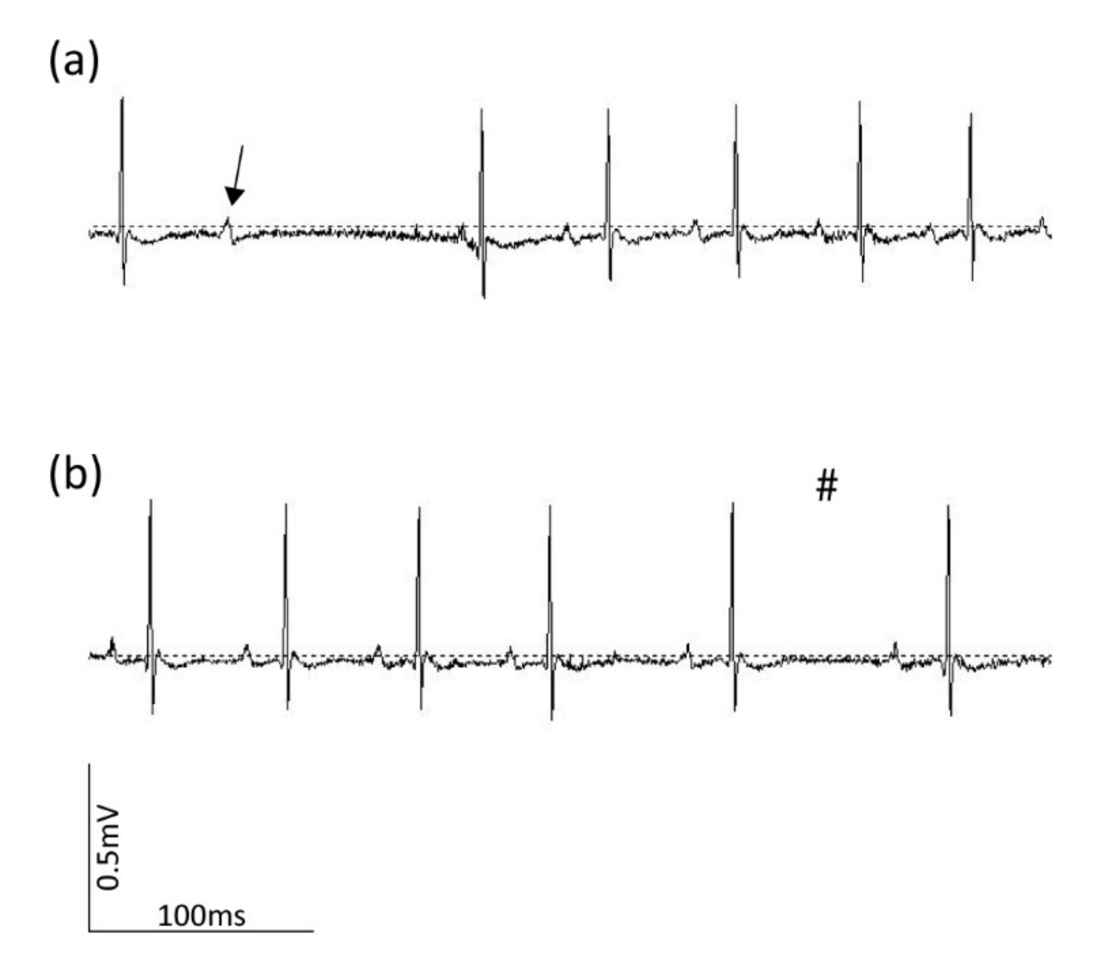 Sensors 20 03867 g007