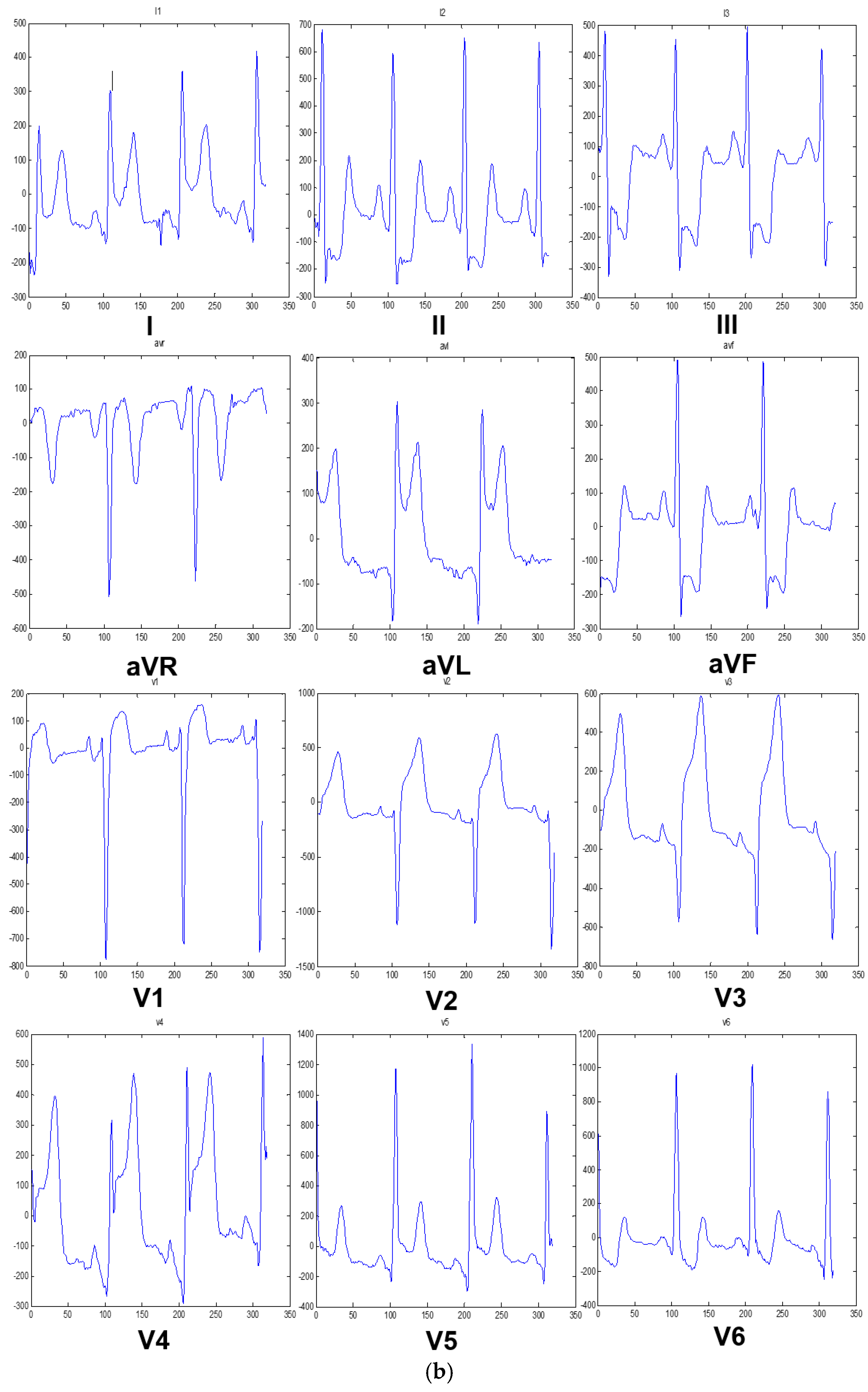 Sensors 20 03975 g002b Sensors 20 03975 g002b