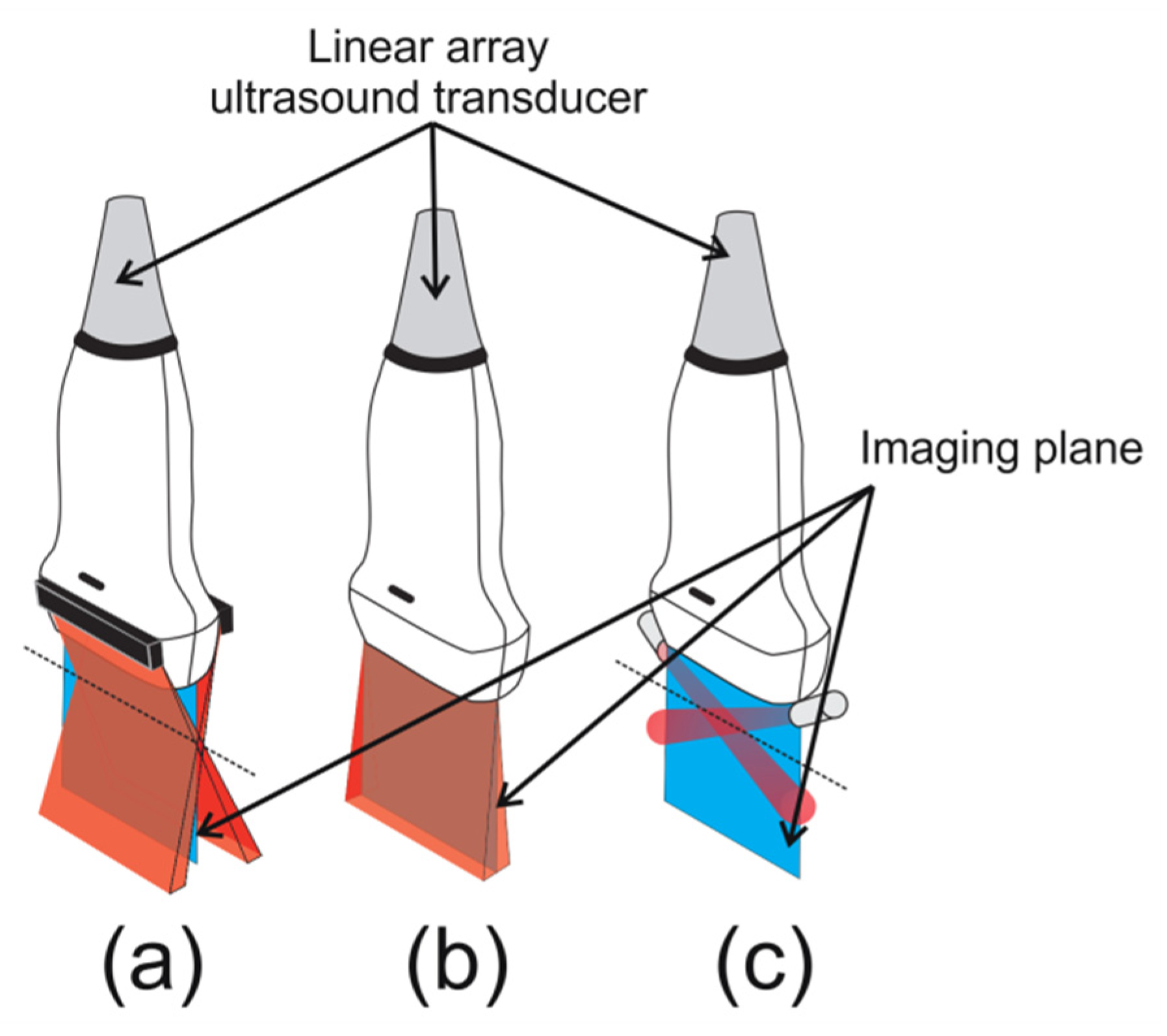 Sensors | Free Full-Text | Multiangle Long-Axis Lateral Illumination ...