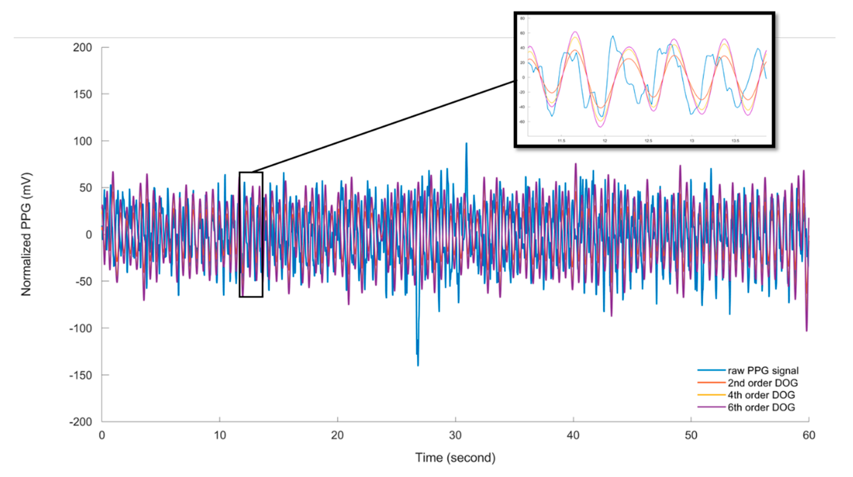 Sensors Free FullText An Approach towards MotionTolerant PPG