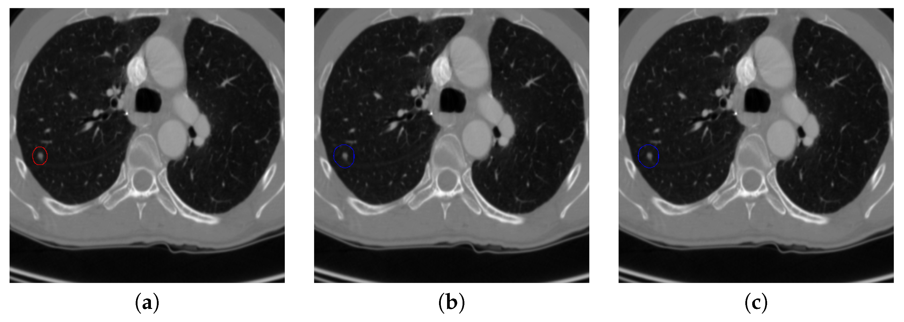 Sensors 20 04301 g017a