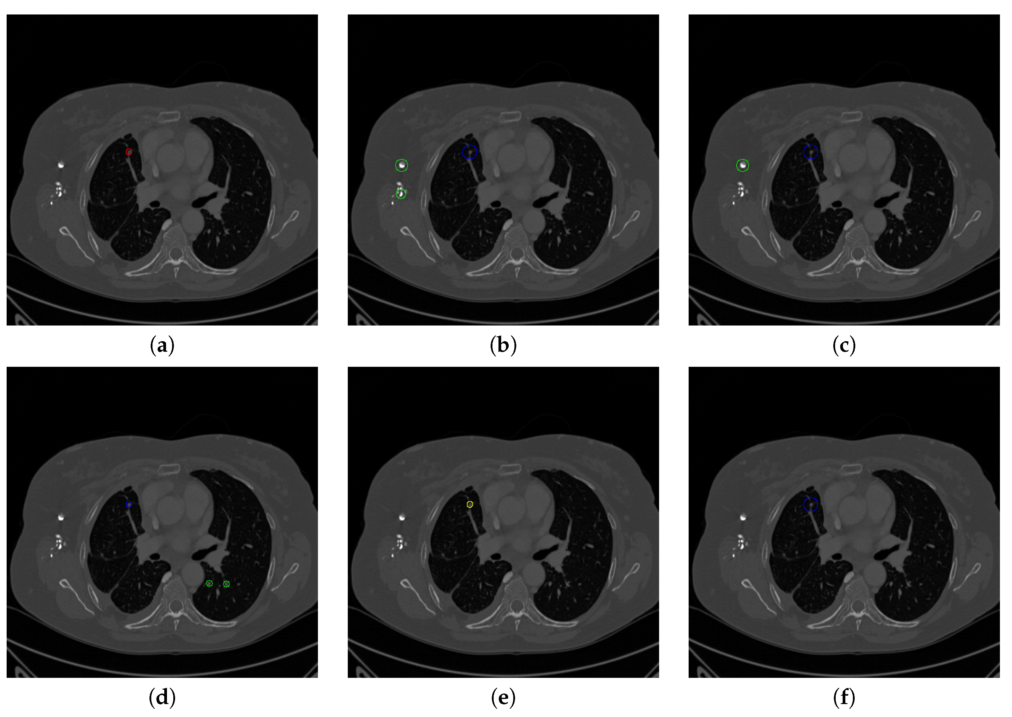 Sensors 20 04301 g018a