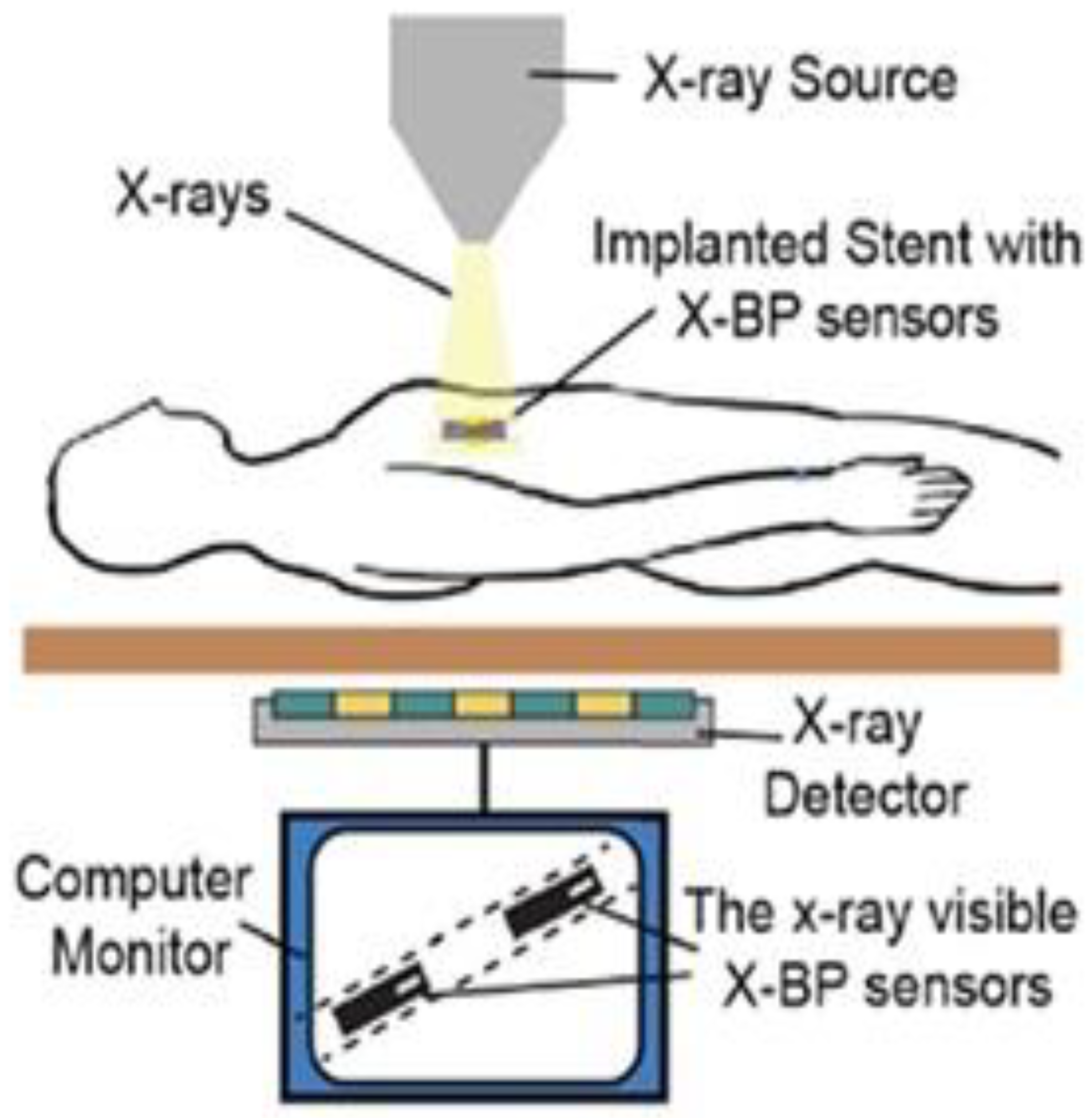 Sensors 20 04303 g005 Sensors 20 04303 g005