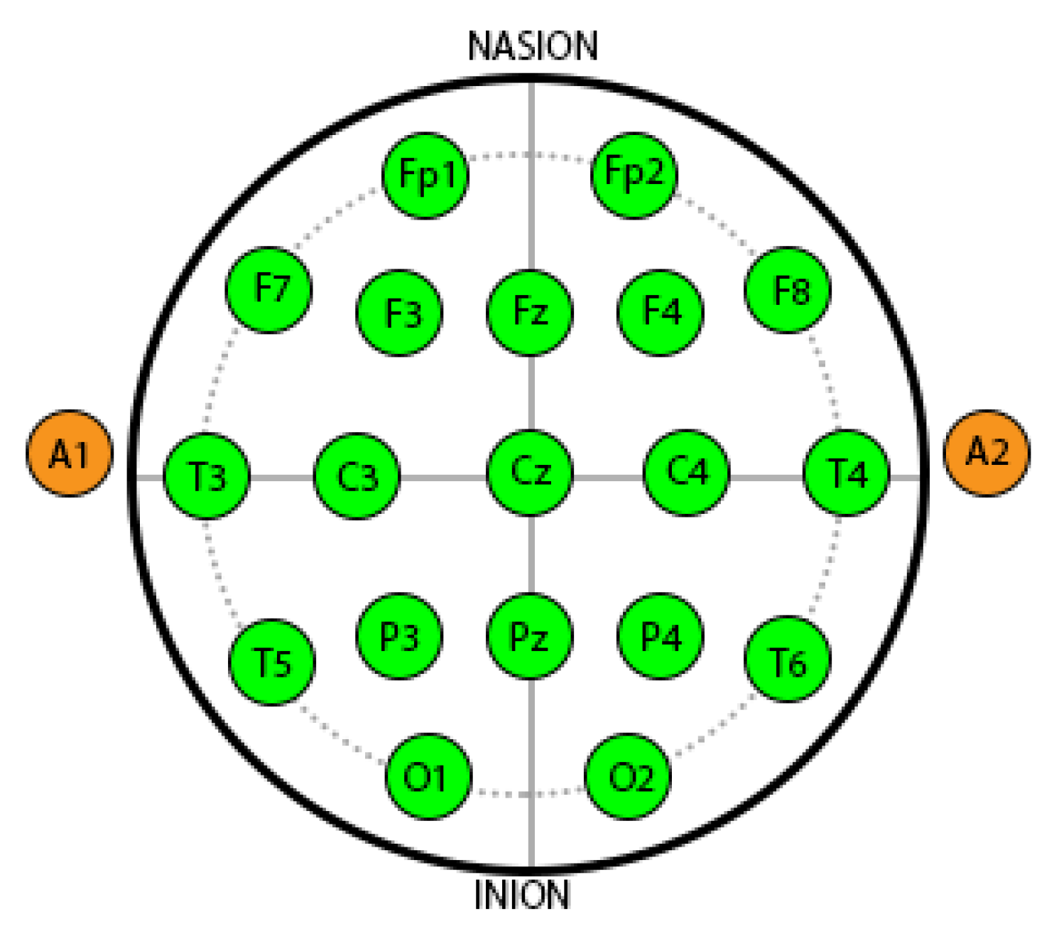 Sensors 20 04400 g004