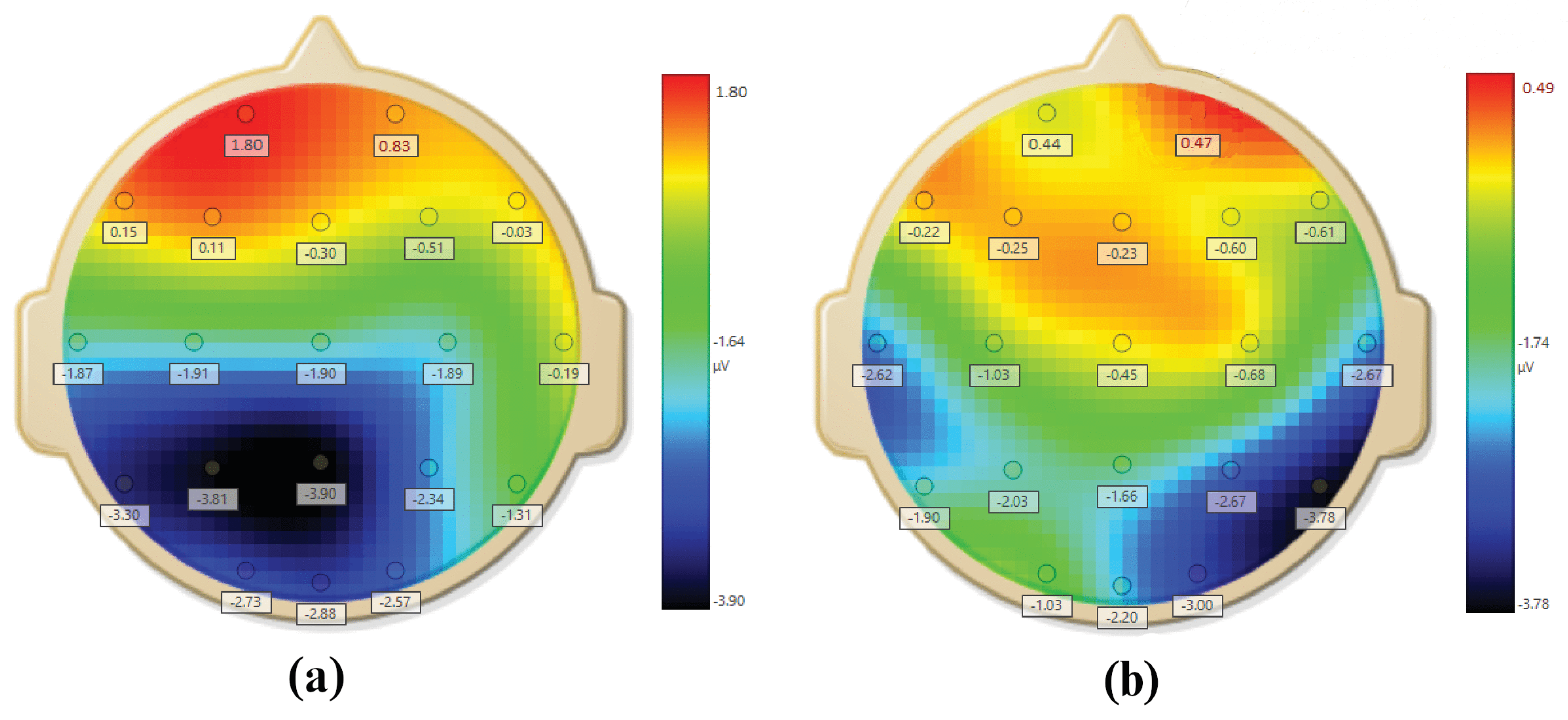 Sensors 20 04400 g005