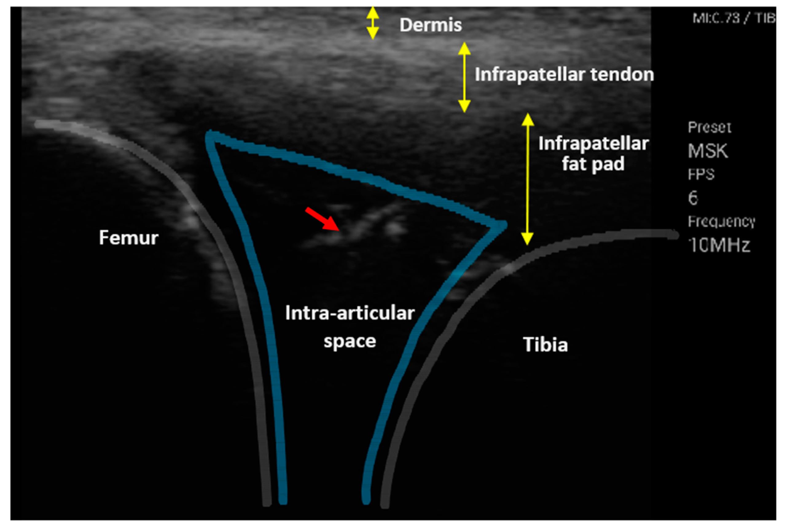 Sensors 20 04625 g007 Sensors 20 04625 g007