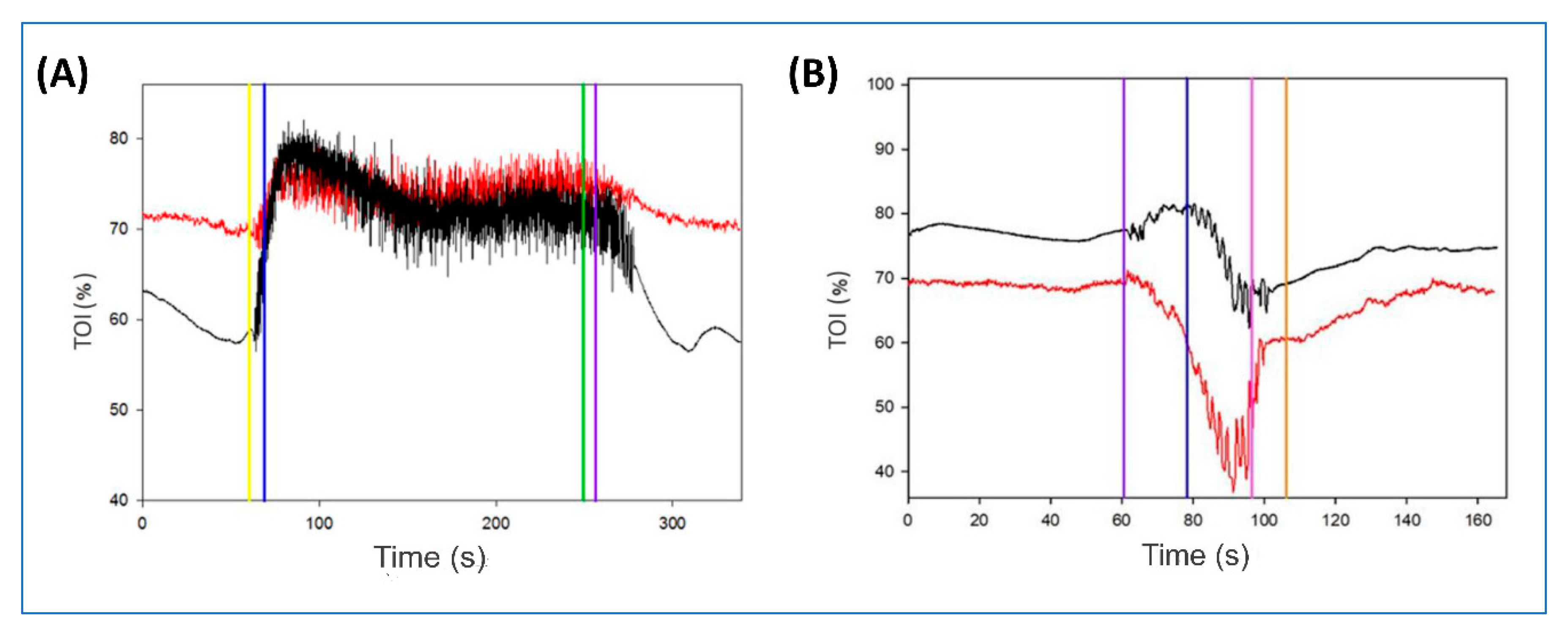 Sensors 20 04664 g004