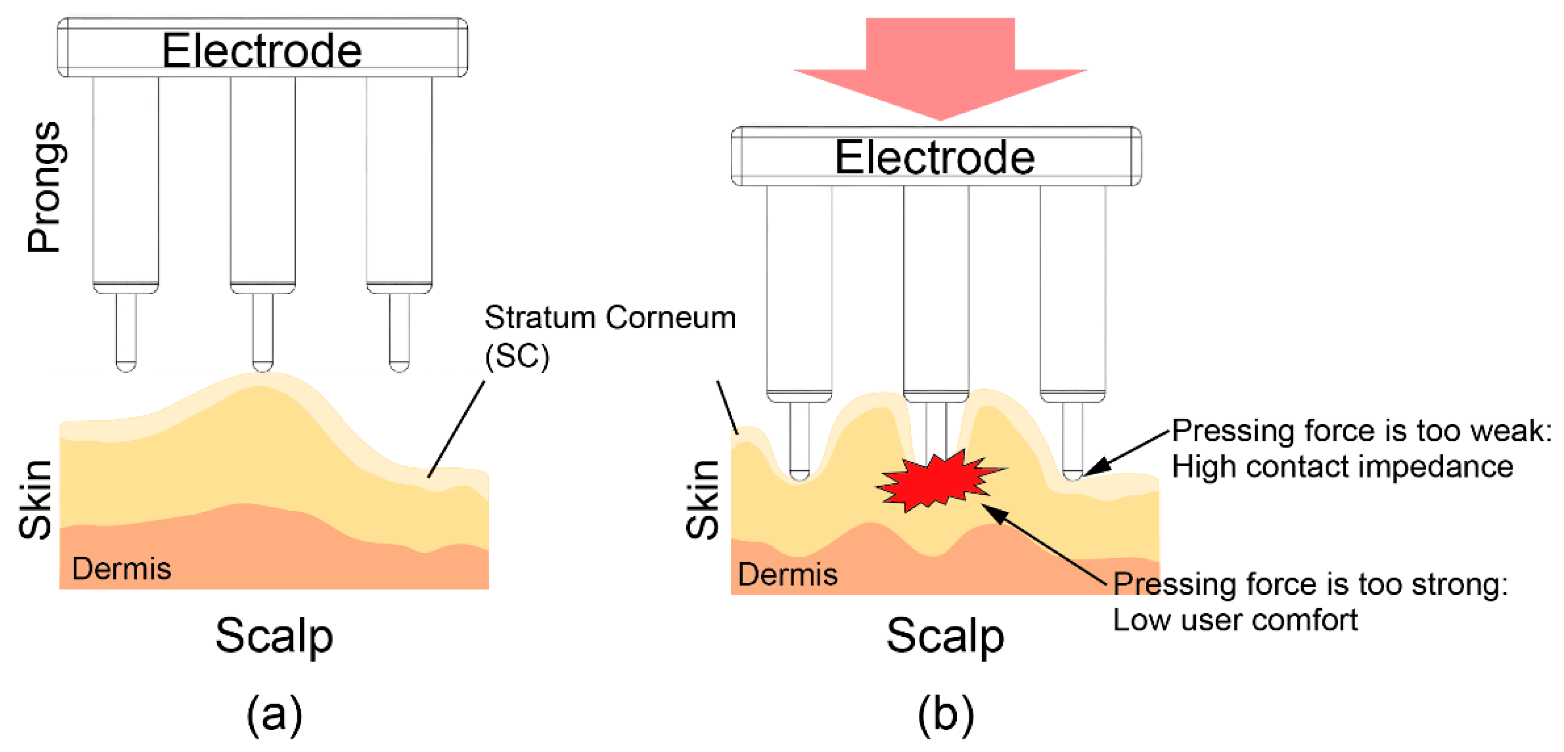 Sensors Free FullText 3D Printable Dry EEG Electrodes with Coiled