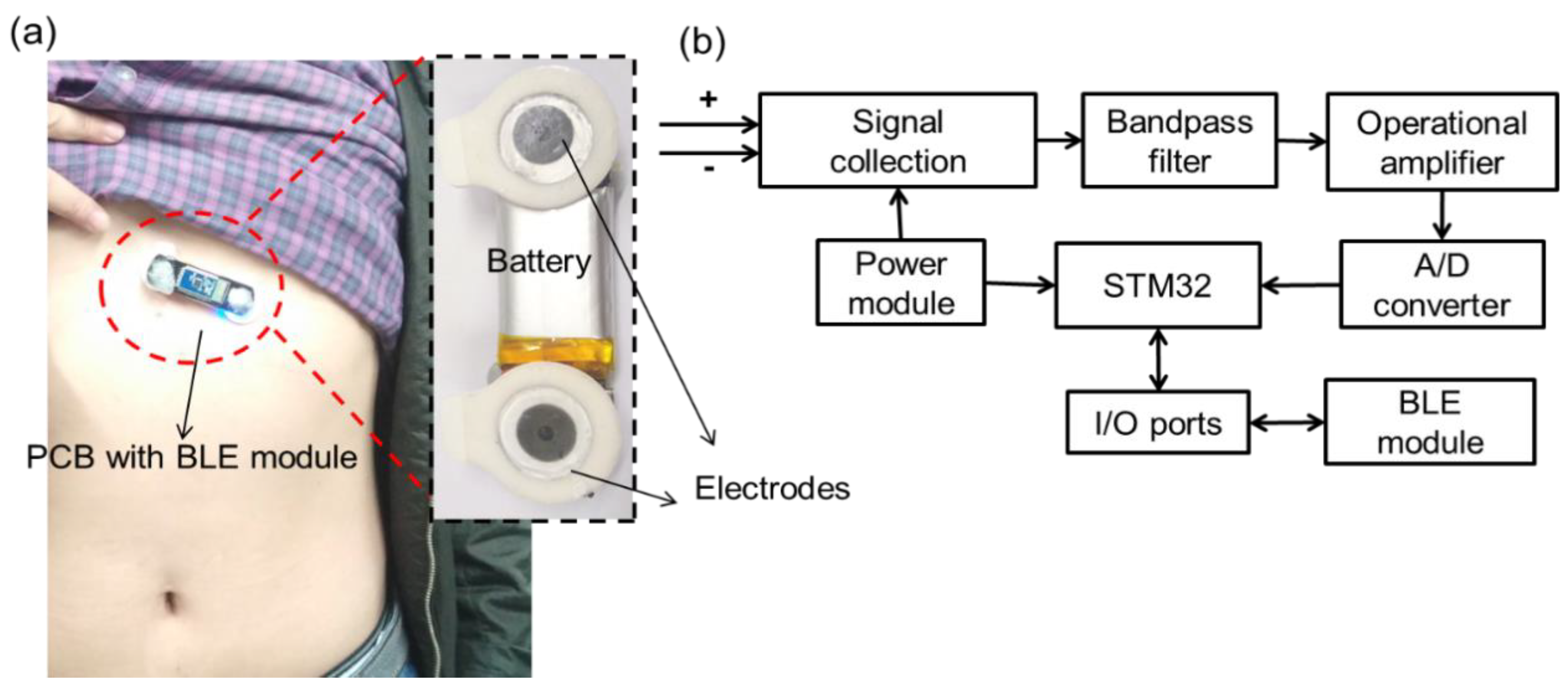 Sensors | Free Full-Text | Wearable Physiological Monitoring System Based  on Electrocardiography and Electromyography for Upper Limb Rehabilitation  Training