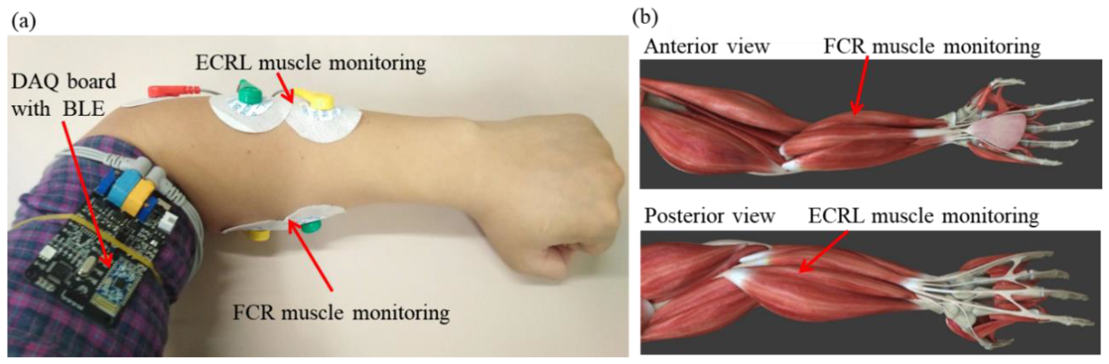 Sensors 20 04861 g002 Sensors 20 04861 g002