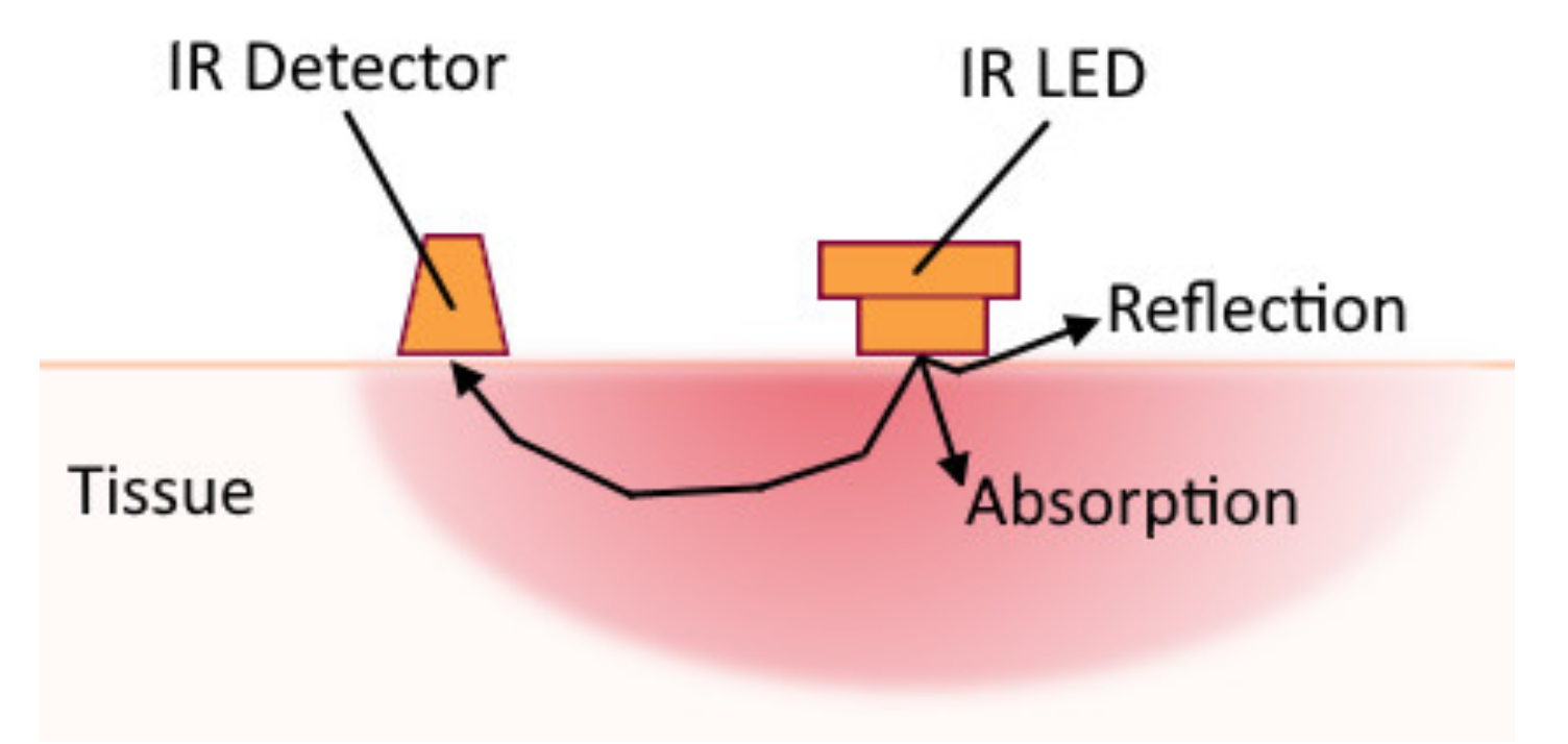 Sensors 20 04883 g004 Sensors 20 04883 g004