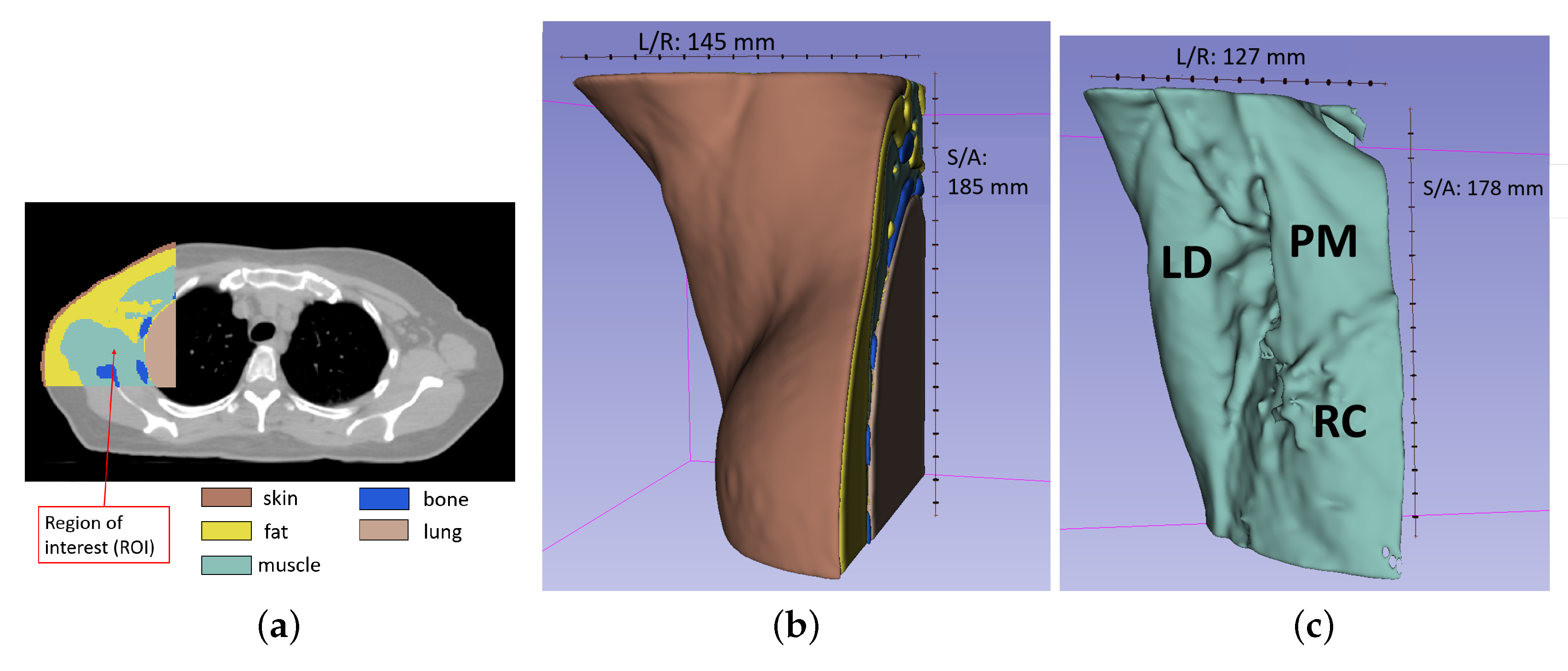 Sensors 20 04968 g007