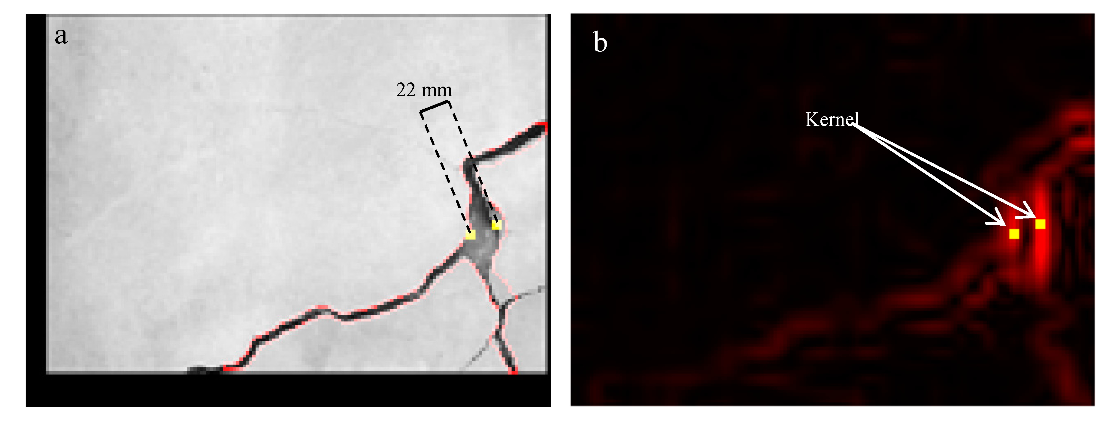 Sensors 20 04980 g006 Sensors 20 04980 g006
