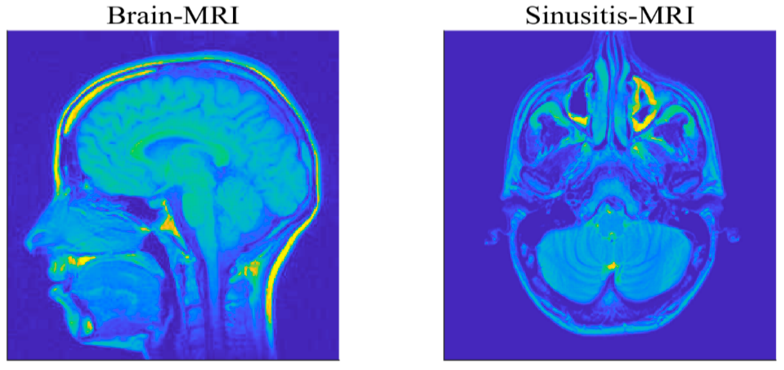 Sensors 20 05384 g012