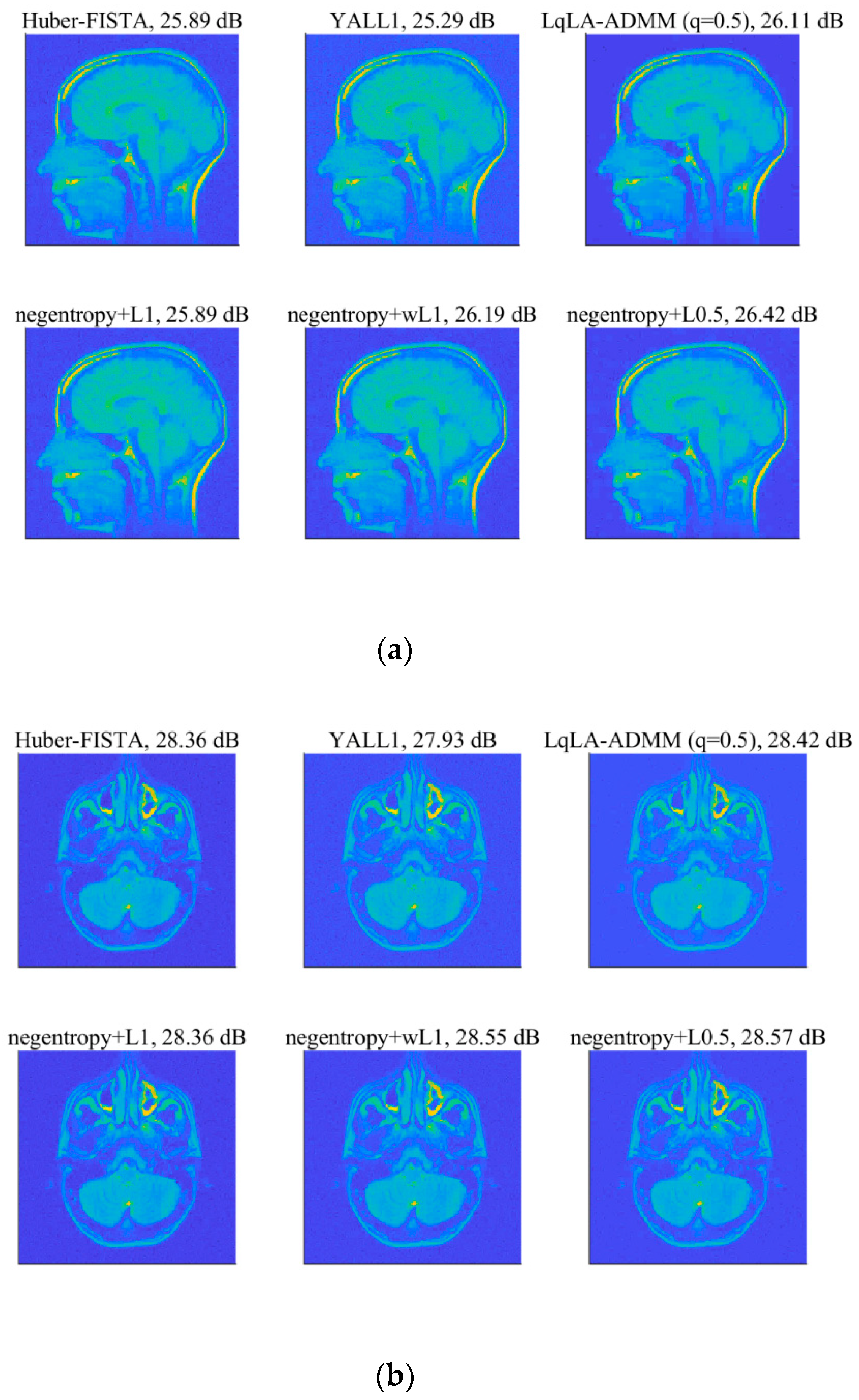 Sensors 20 05384 g013