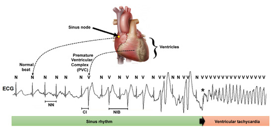 Prediction of Sudden Cardiac Death Risk with a Support