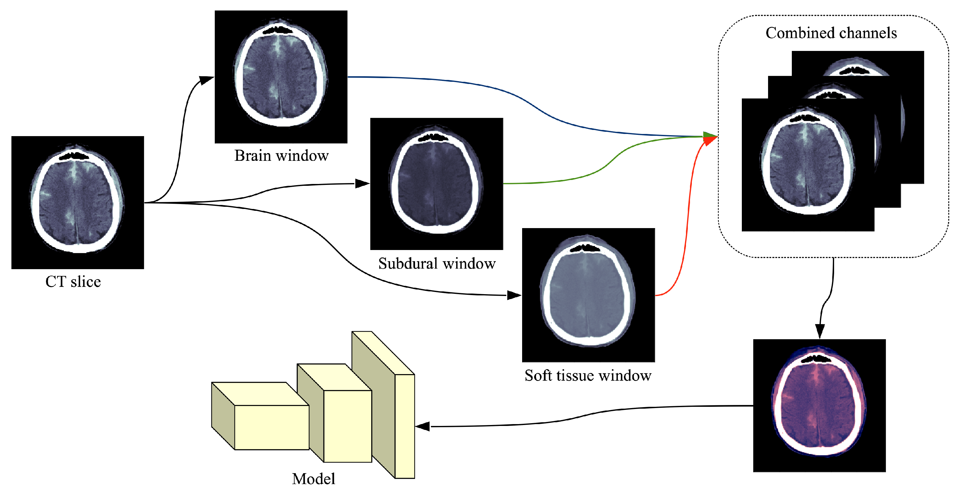 https://www.mdpi.com/sensors/sensors-20-05611/article_deploy/html/images/sensors-20-05611-g001.png