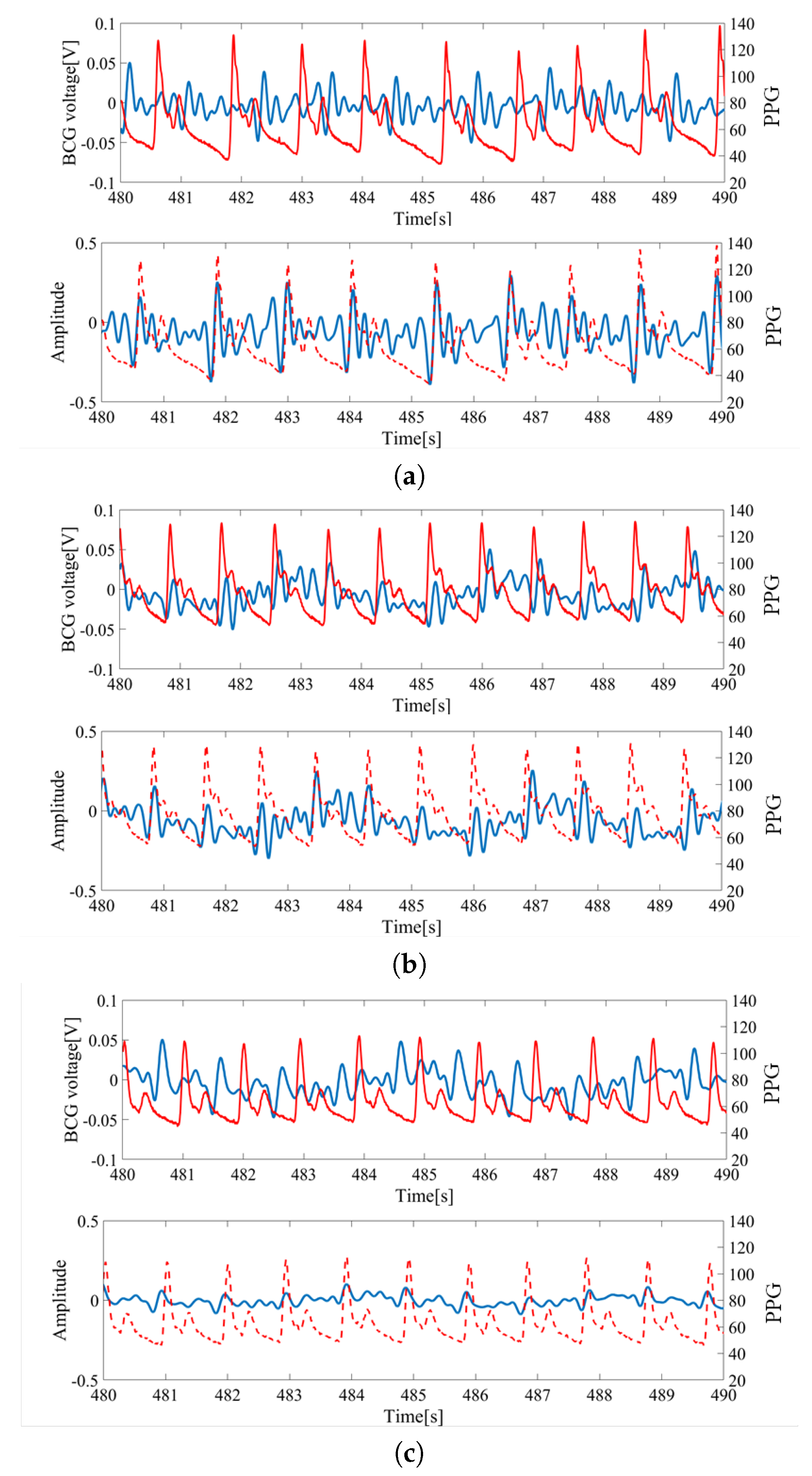 Sensors Free Full Text Sleep Stage Estimation From Bed Leg Ballistocardiogram Sensors Html Sensors Free Full Text Sleep Stage Estimation From Bed Leg Ballistocardiogram Sensors Html