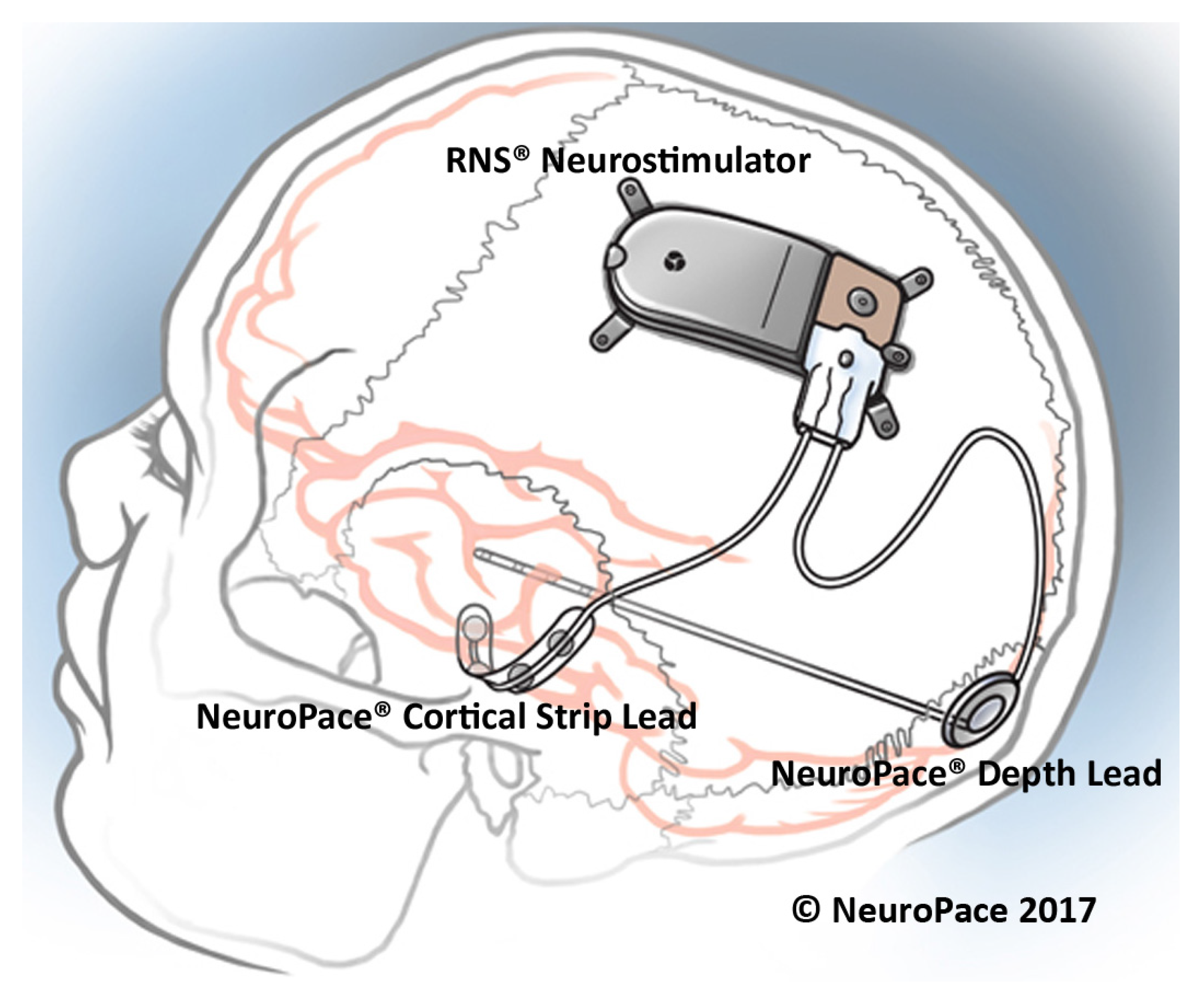 Sensors 20 05716 g009 Sensors 20 05716 g009
