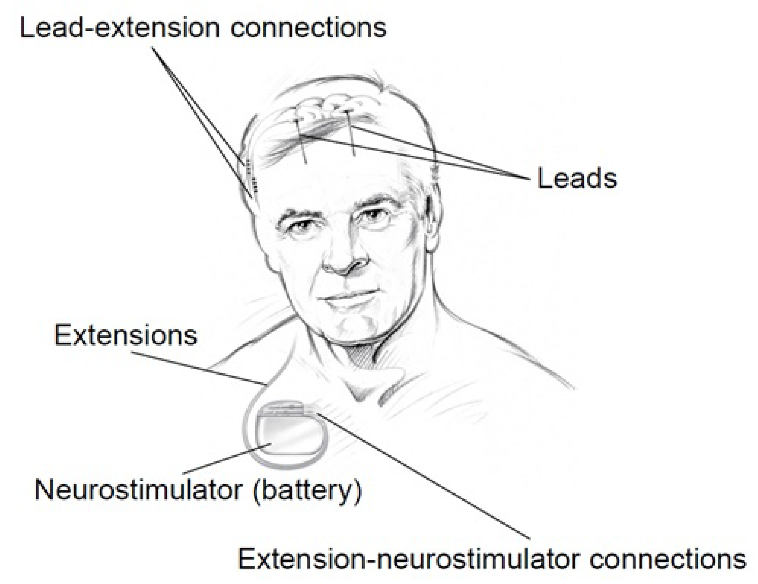 Sensors 20 05716 g010 Sensors 20 05716 g010