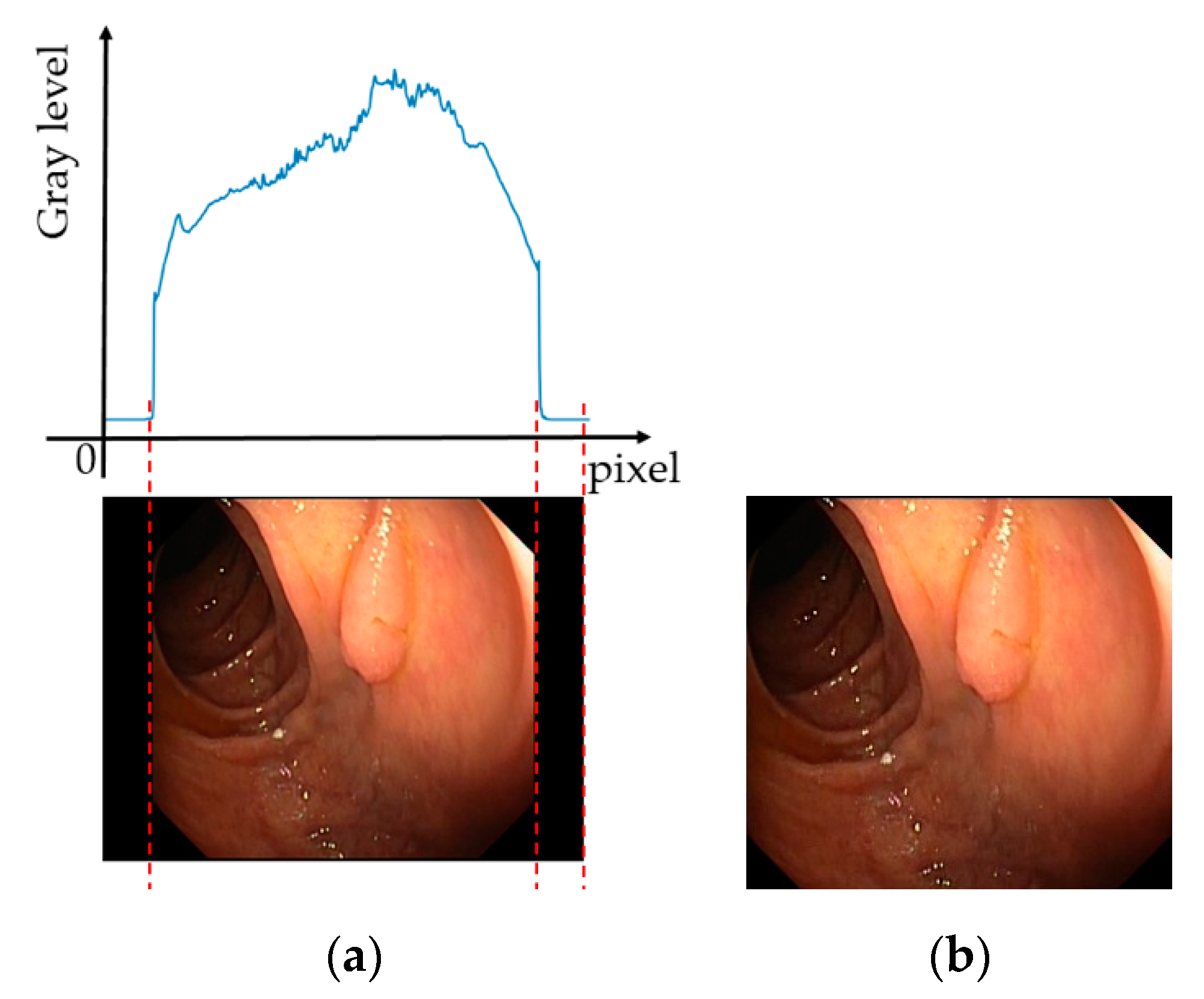 Sensors 20 05982 g002