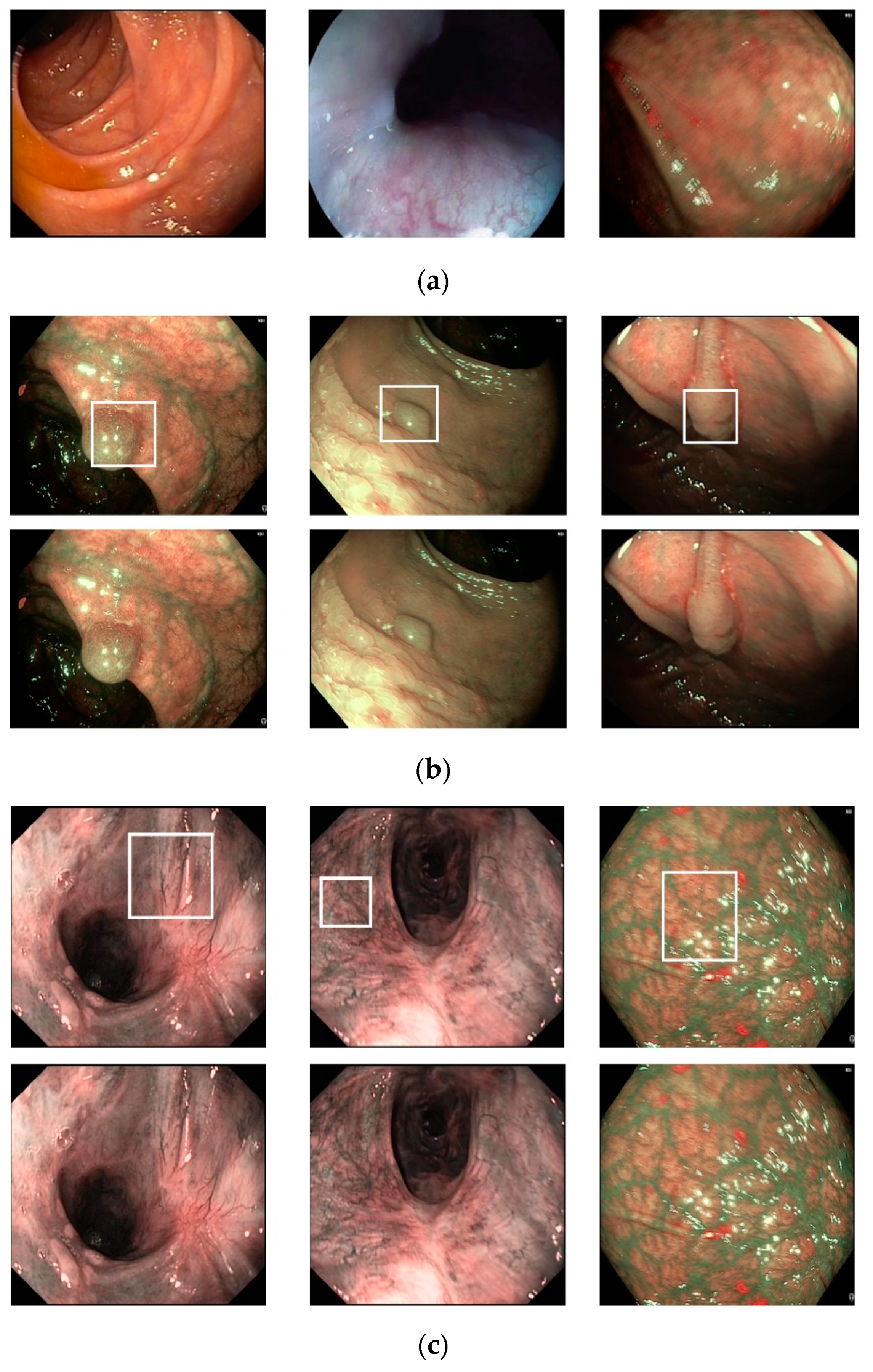 Sensors 20 05982 g009