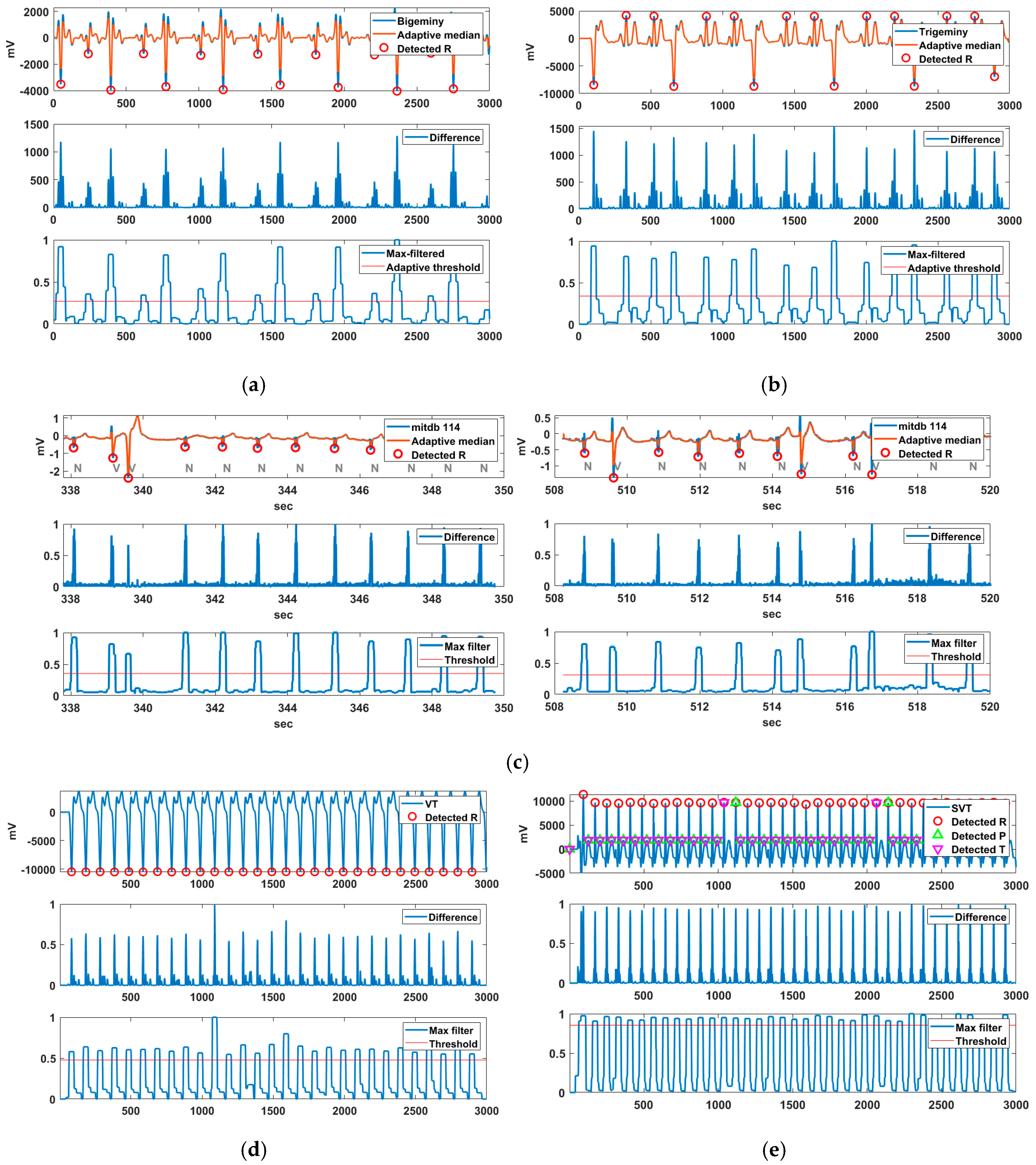 Sensors 20 06144 g011 Sensors 20 06144 g011