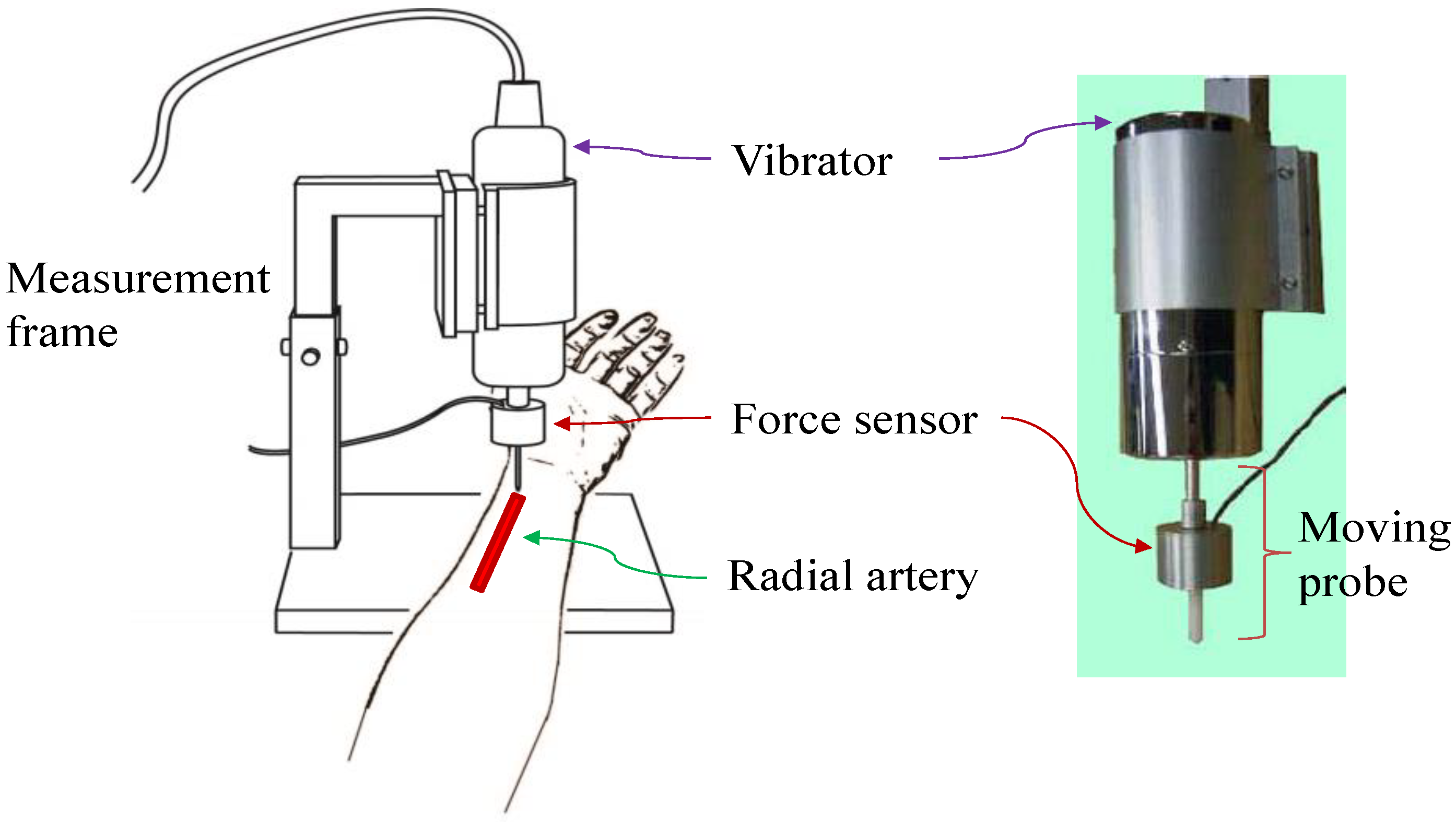 Sensors 20 06463 g004
