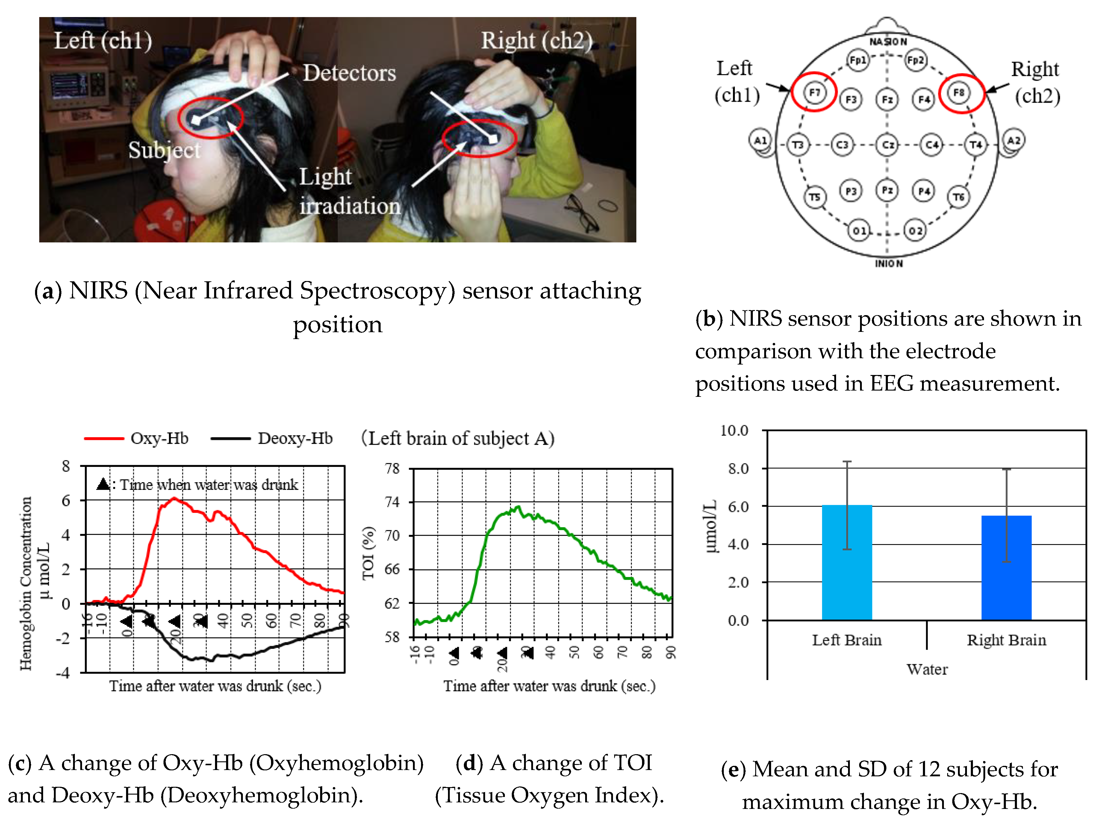 Sensors 20 06615 g004 Sensors 20 06615 g004