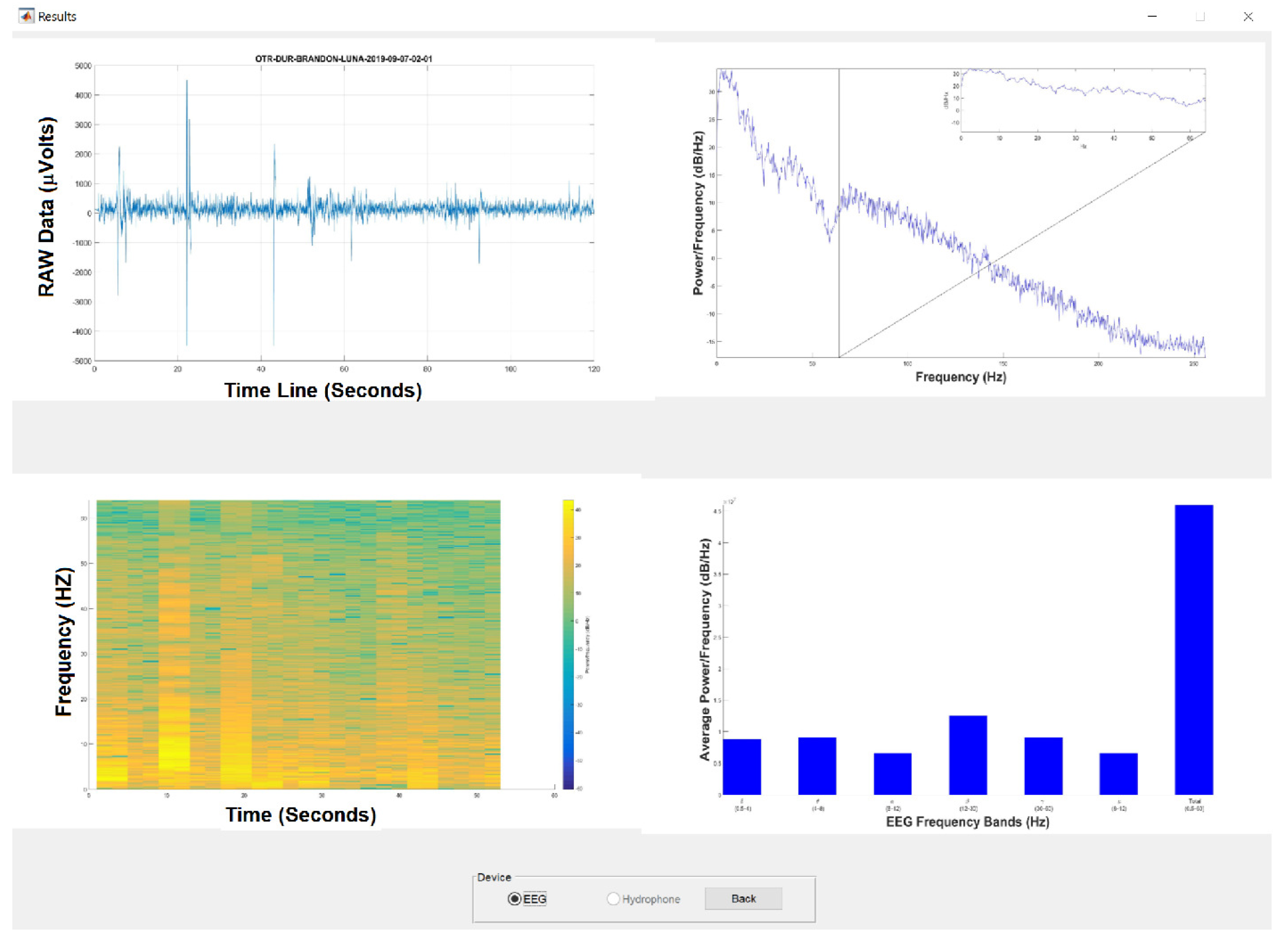 Sensors 20 06991 g020 Sensors 20 06991 g020