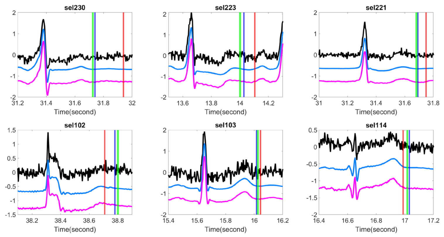 Sensors 20 07052 g002 Sensors 20 07052 g002