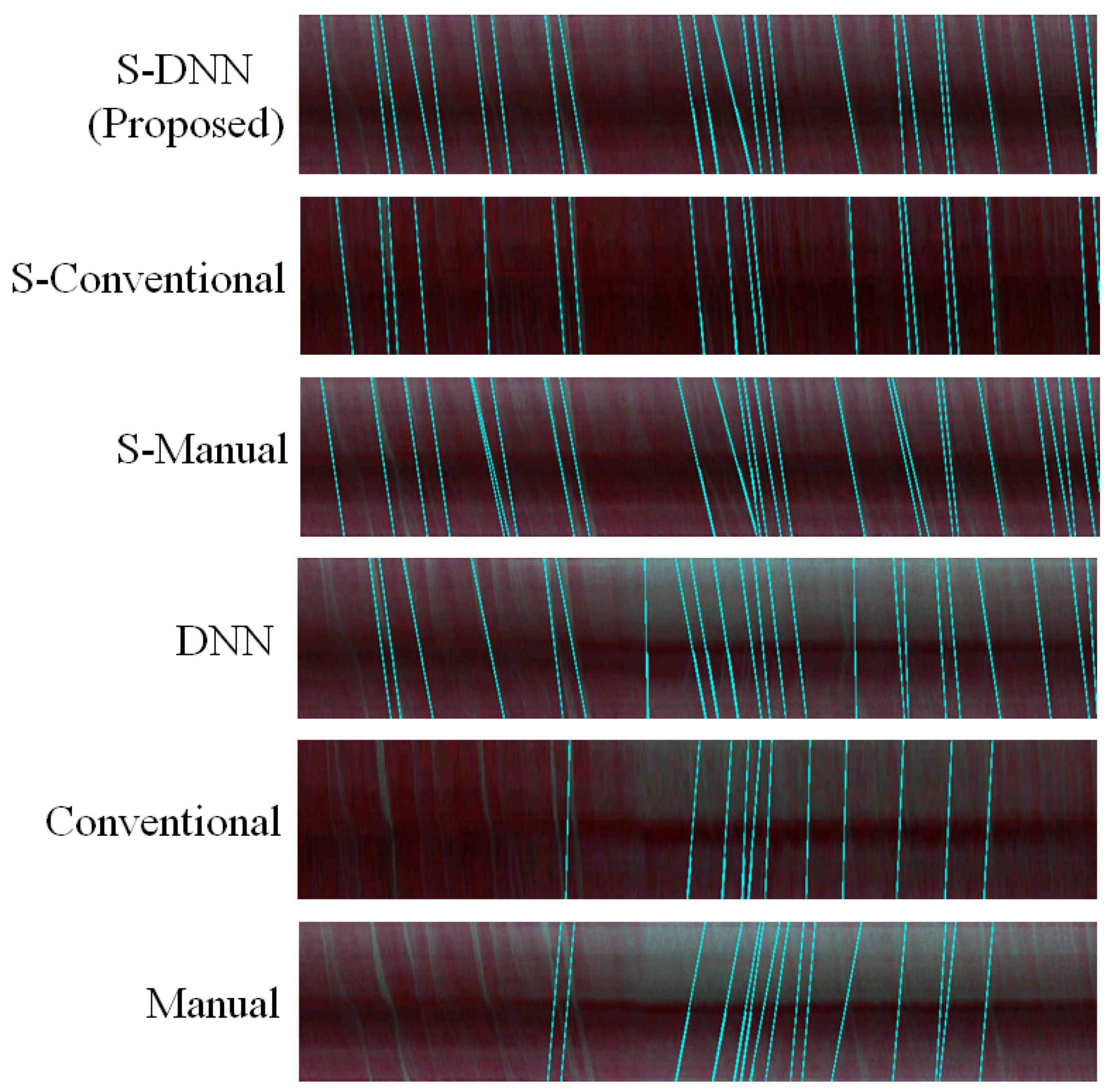 Sensors 20 07101 g0a3